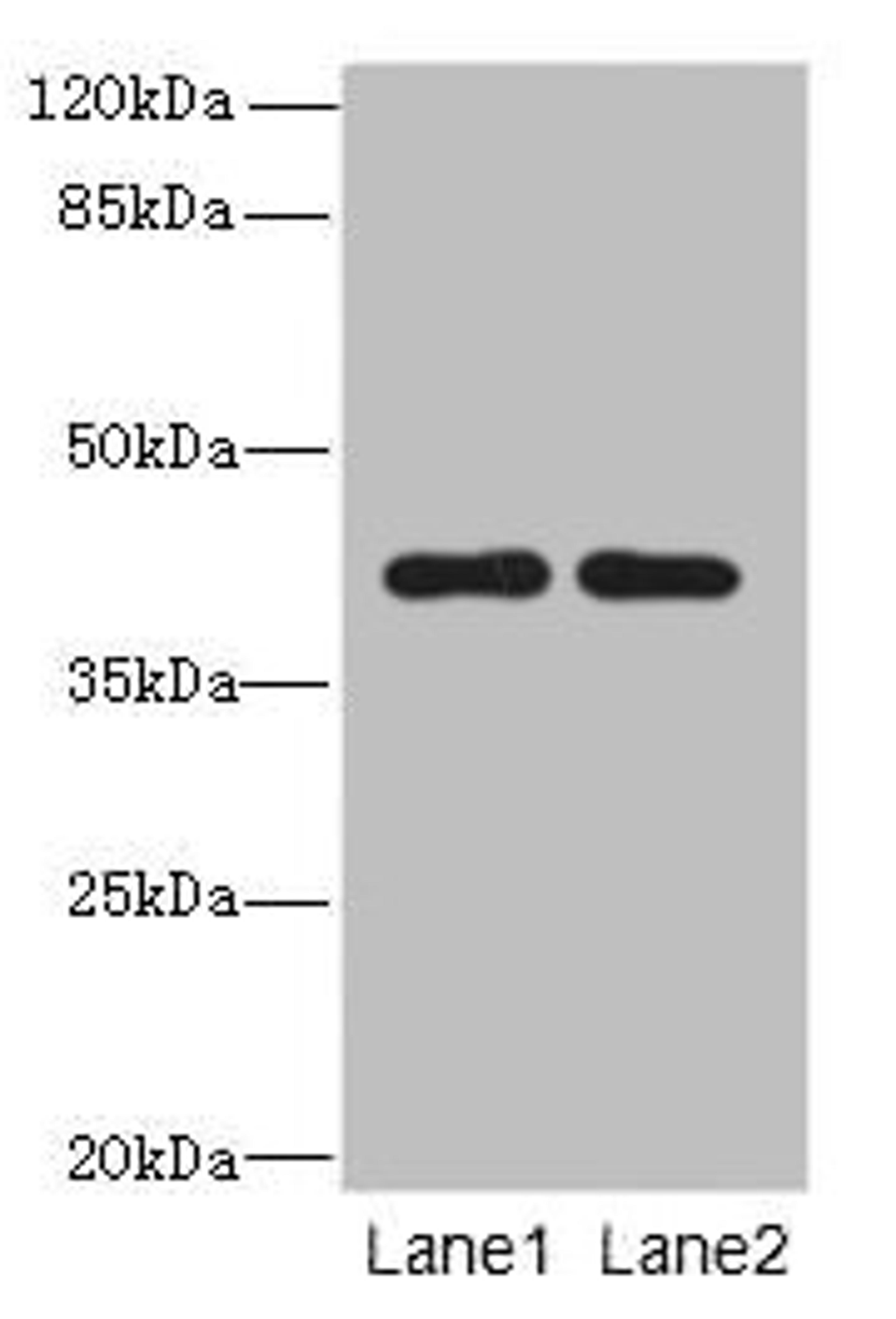 Western blot. All lanes: CIPC antibody at 6ug/ml. Lane 1: A431 whole cell lysate. Lane 2: NIH/3T3 whole cell lysate. Secondary. Goat polyclonal to rabbit IgG at 1/10000 dilution. Predicted band size: 43 kDa. Observed band size: 43 kDa. 