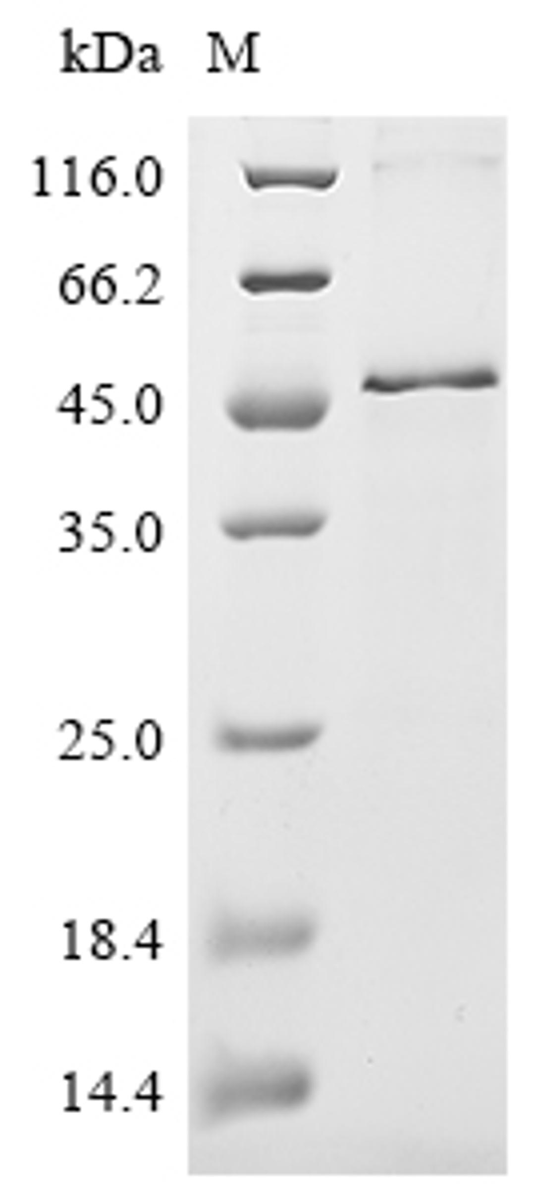 (Tris-Glycine gel) Discontinuous SDS-PAGE (reduced) with 5% enrichment gel and 15% separation gel.