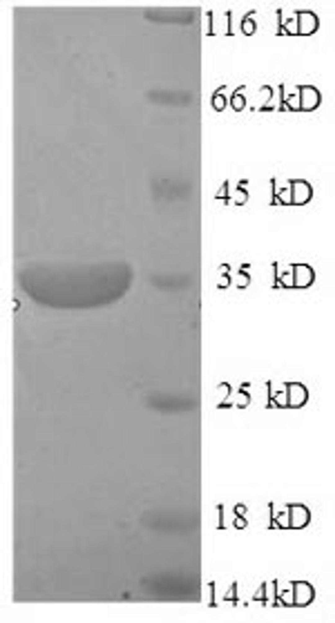 (Tris-Glycine gel) Discontinuous SDS-PAGE (reduced) with 5% enrichment gel and 15% separation gel.