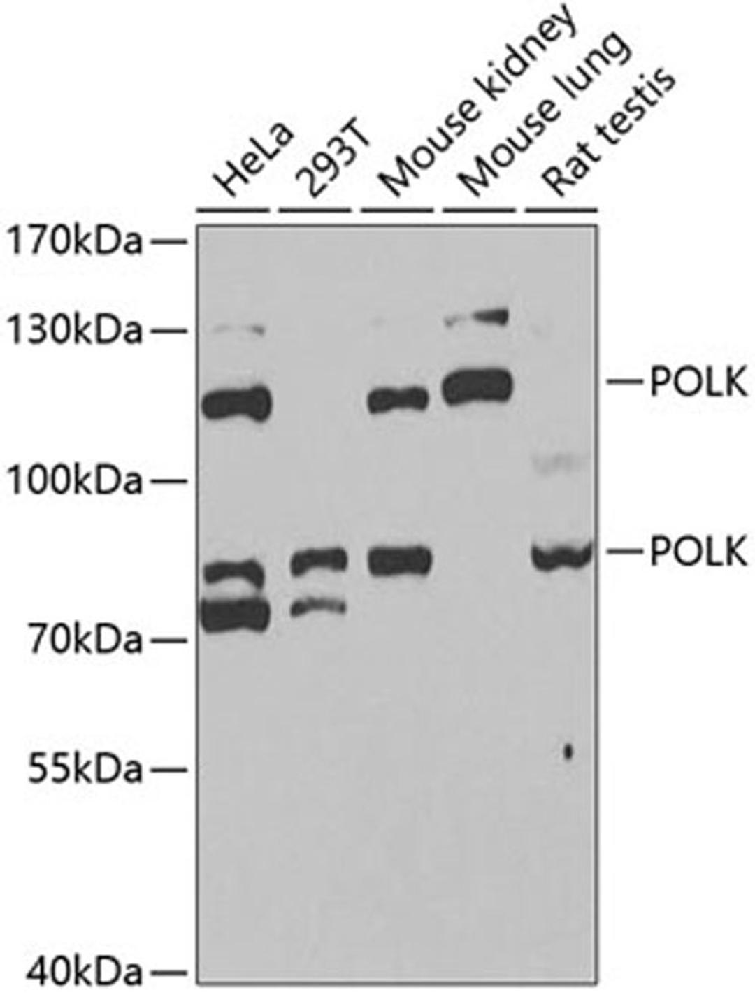 Western blot - POLK antibody (A6122)