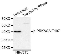 Western blot analysis of extracts of NIH/3T3 cells using PRKACA (Phospho-T197) antibody