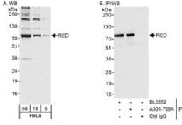 Detection of human RED by western blot and immunoprecipitation.