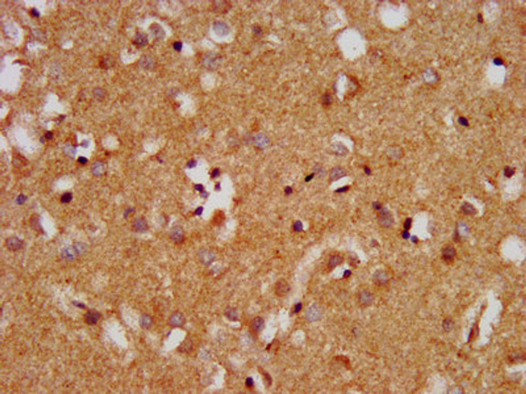 IHC image of CSB-PA013400LA01HU diluted at 1:400 and staining in paraffin-embedded human brain tissue performed on a Leica BondTM system. After dewaxing and hydration, antigen retrieval was mediated by high pressure in a citrate buffer (pH 6.0). Section was blocked with 10% normal goat serum 30min at RT. Then primary antibody (1% BSA) was incubated at 4&deg;C overnight. The primary is detected by a biotinylated secondary antibody and visualized using an HRP conjugated SP system.
