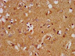 IHC image of CSB-PA013400LA01HU diluted at 1:400 and staining in paraffin-embedded human brain tissue performed on a Leica BondTM system. After dewaxing and hydration, antigen retrieval was mediated by high pressure in a citrate buffer (pH 6.0). Section was blocked with 10% normal goat serum 30min at RT. Then primary antibody (1% BSA) was incubated at 4&deg;C overnight. The primary is detected by a biotinylated secondary antibody and visualized using an HRP conjugated SP system.