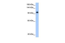 Antibody used in WB on Transfected 293T at 0.2-1 ug/ml.