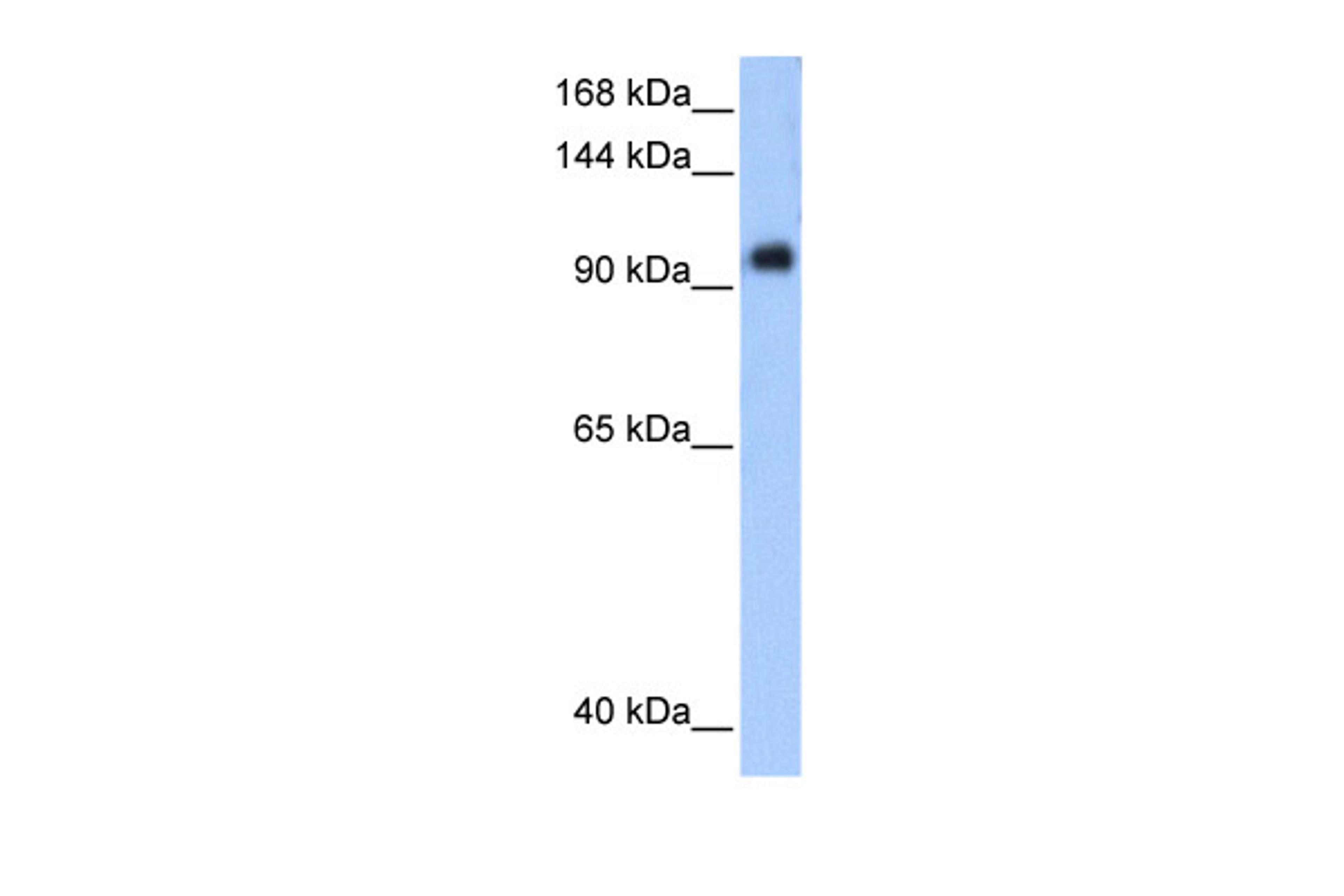 Antibody used in WB on Transfected 293T at 0.2-1 ug/ml.