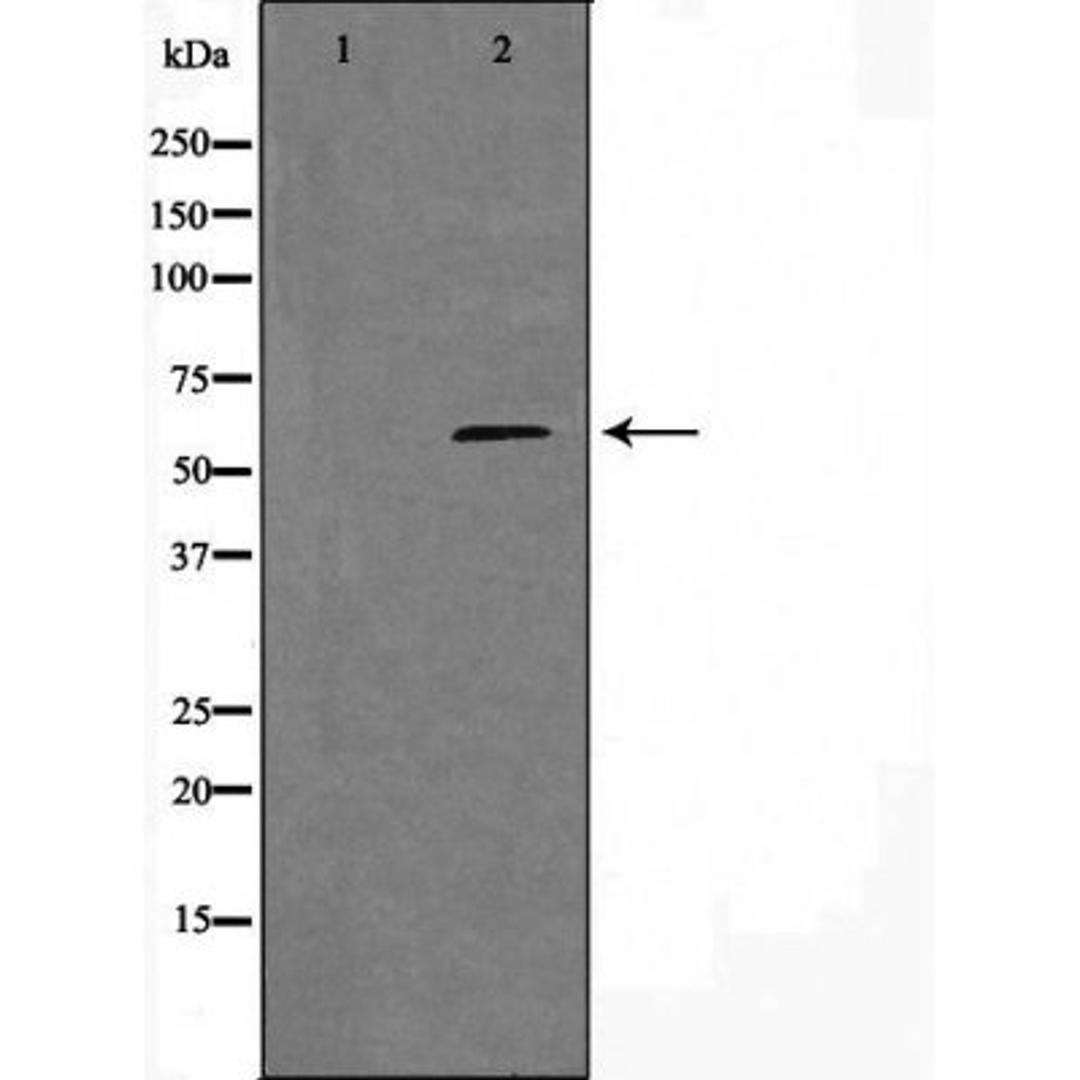 Western blot analysis of HeLa cells and A549 cells using 11A1 (Cytochrome P450) antibody