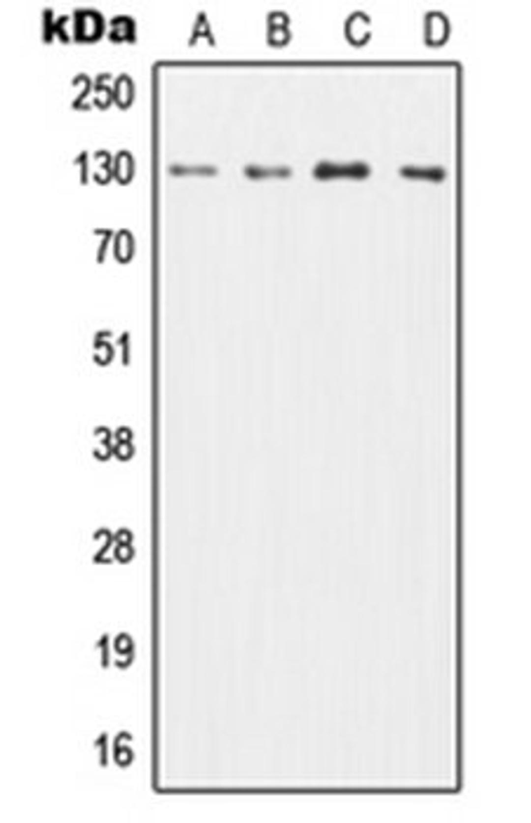 Western blot analysis of HL60 (Lane 1), TF1 (Lane 2), SP2/0 (Lane 3), H9C2 (Lane 4) whole cell lysates using CSF2RB antibody