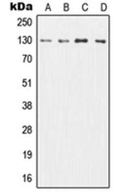 Western blot analysis of HL60 (Lane 1), TF1 (Lane 2), SP2/0 (Lane 3), H9C2 (Lane 4) whole cell lysates using CSF2RB antibody