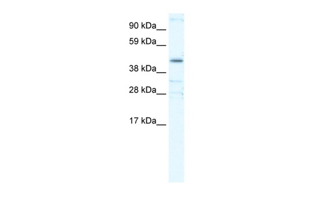 Antibody used in WB on Human Thymus at 0.2-1 ug/ml.