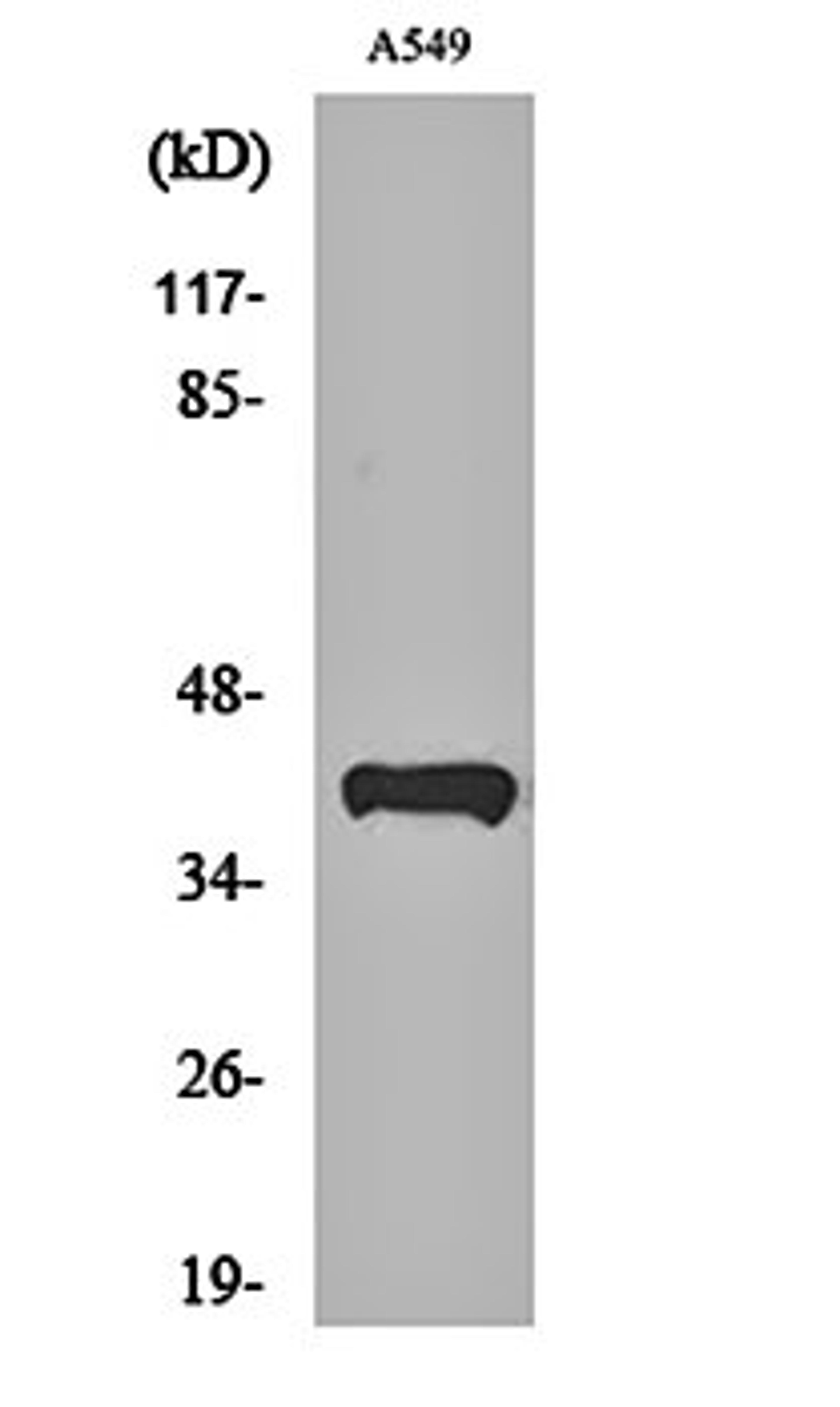 Western blot analysis of A549 cell lysates using Peroxin 14 antibody