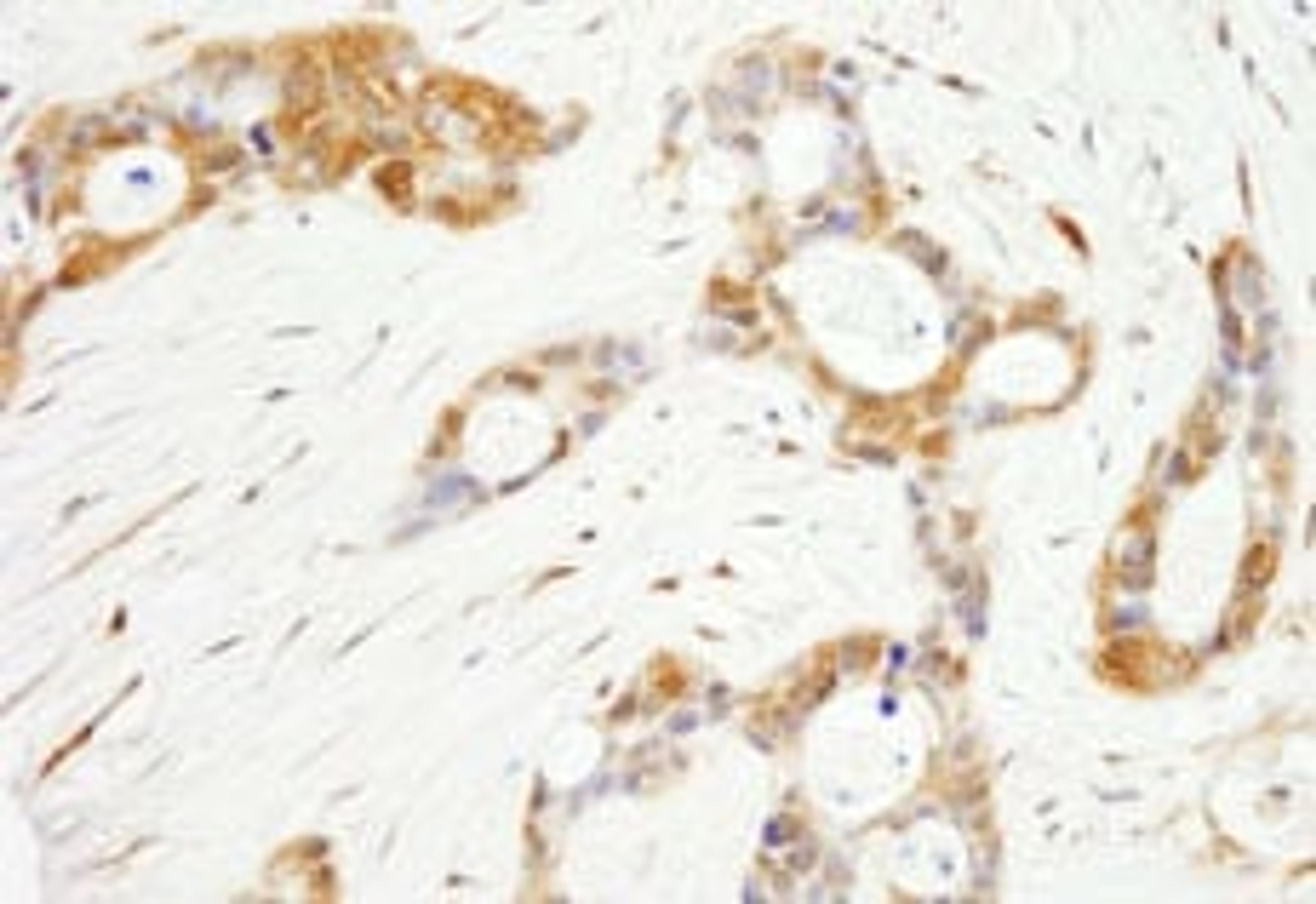 Detection of human OSR1 by immunohistochemistry.