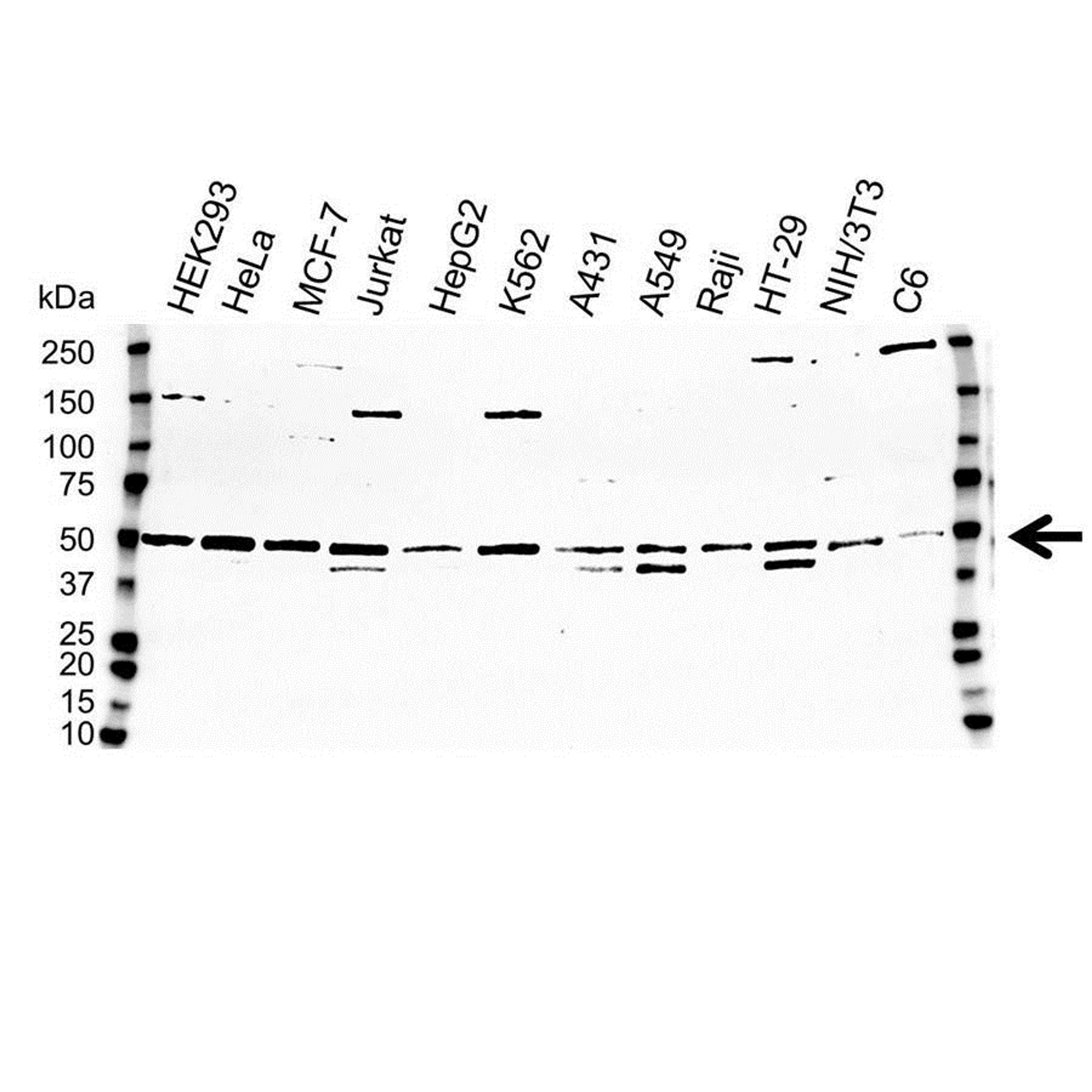 Western blot analysis of whole cell lysates probed with IKK gamma antibody