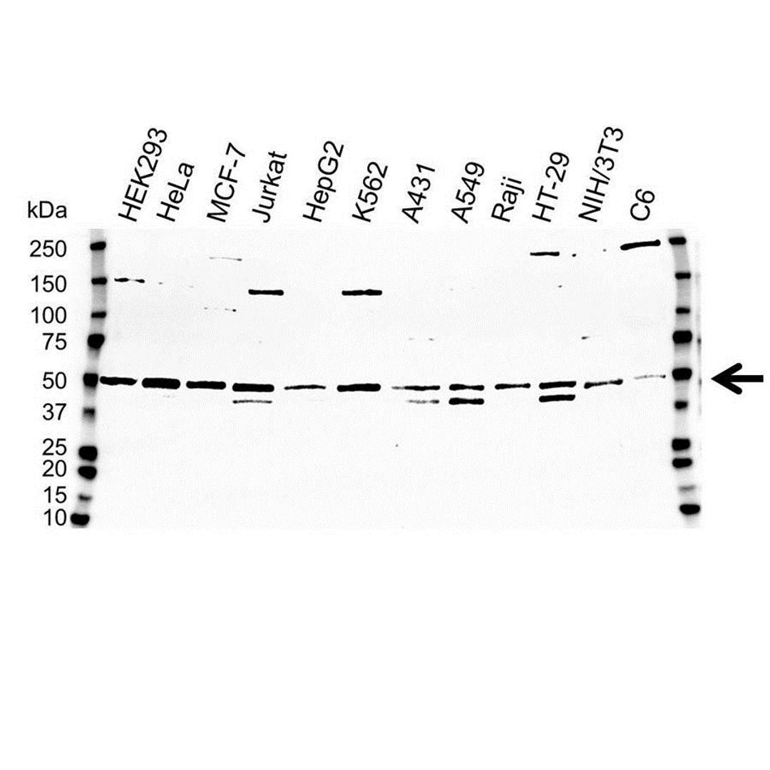 Western blot analysis of whole cell lysates probed with IKK gamma antibody