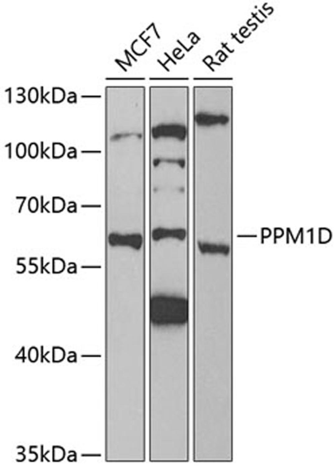 Western blot - PPM1D antibody (A6204)