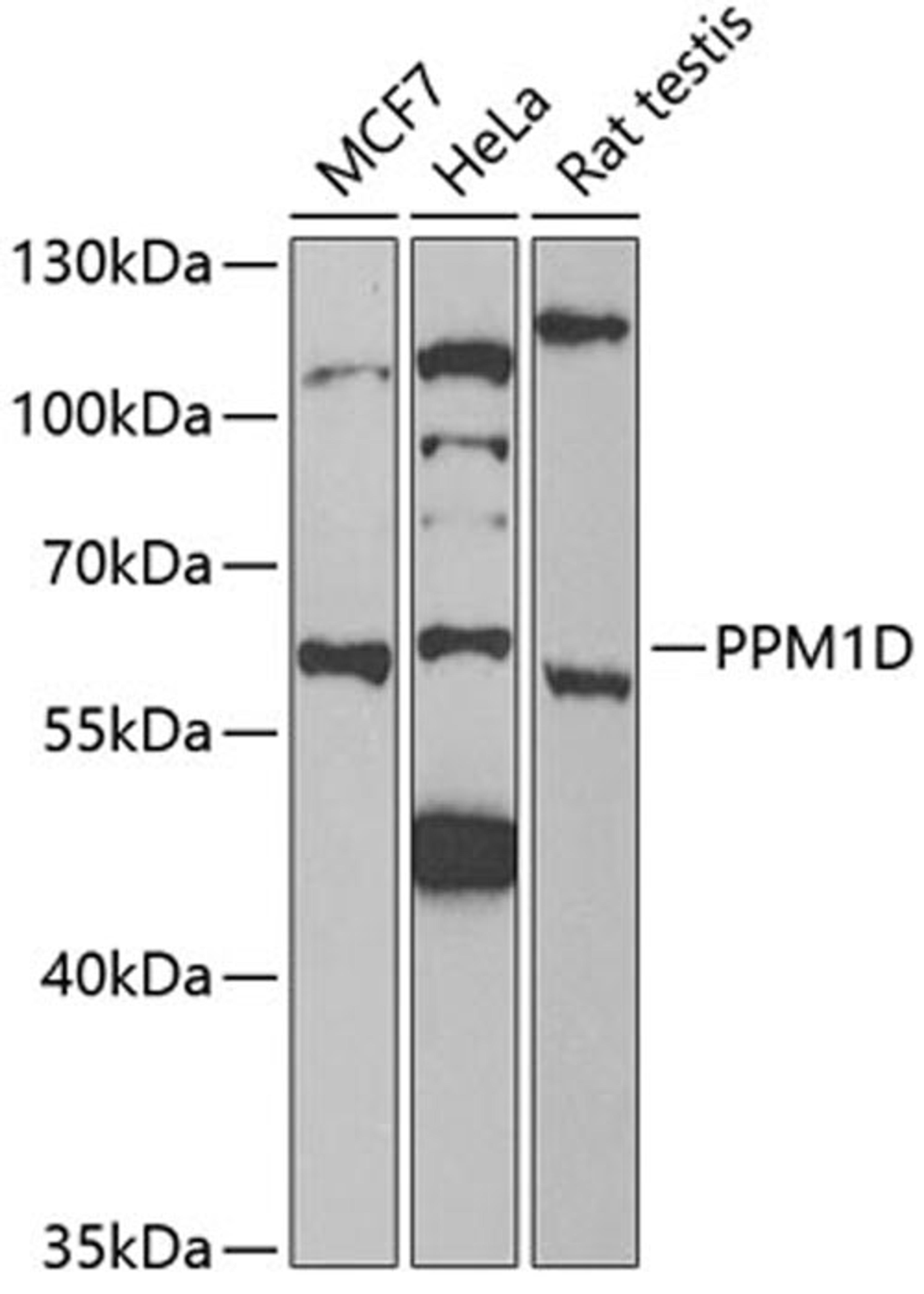 Western blot - PPM1D antibody (A6204)