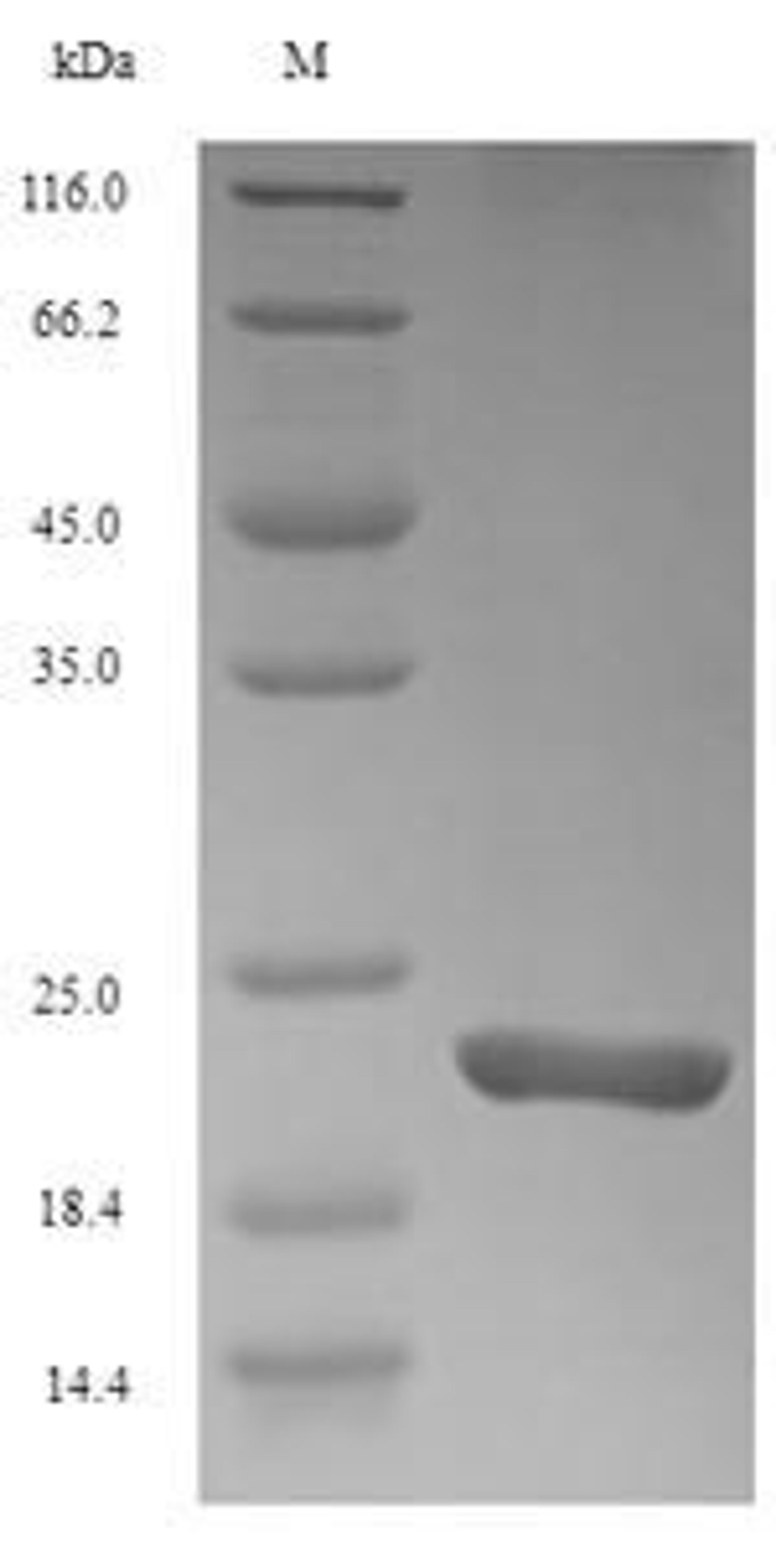 (Tris-Glycine gel) Discontinuous SDS-PAGE (reduced) with 5% enrichment gel and 15% separation gel.