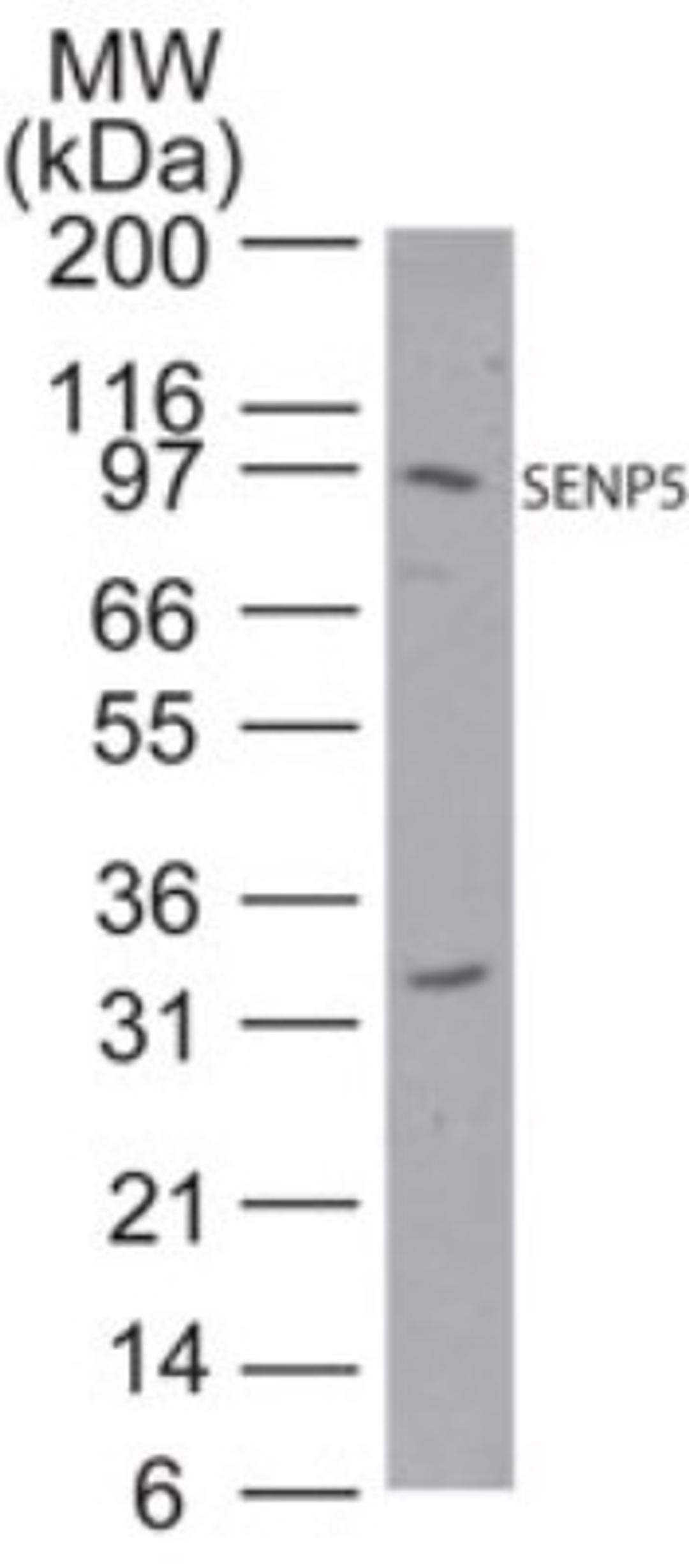 Western Blot: SENP5 Antibody [NB100-56412] - Analysis using SENP5 antibody. Lysate from human HeLa cells probed with SENP5 antibody at 1:250.