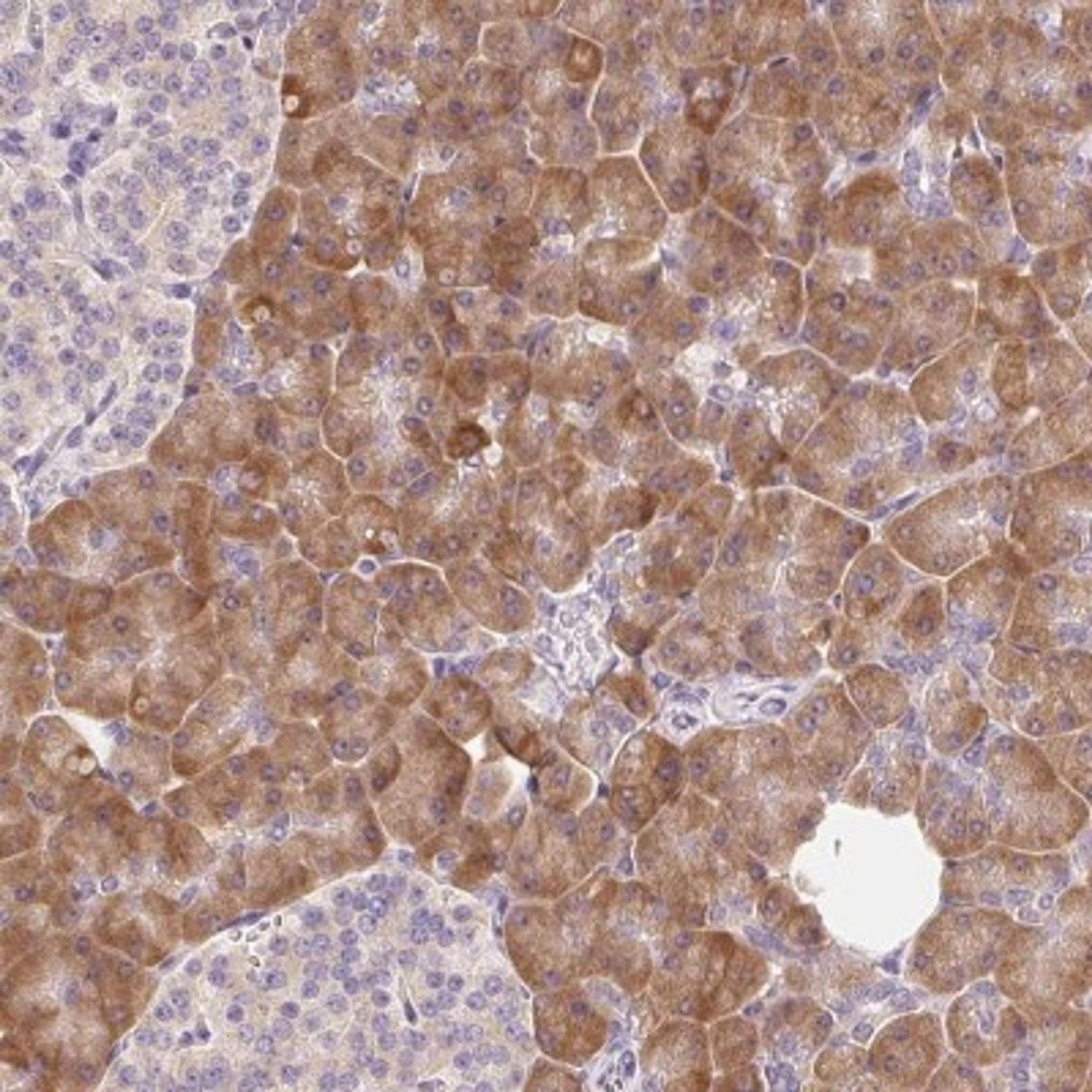 Immunohistochemistry: RPL18A Antibody [NBP2-30708] - Immunohistochemical staining of human pancreas shows moderate cytoplasmic positivity in exocrine glandular cells,islets of Langerhans were negative.