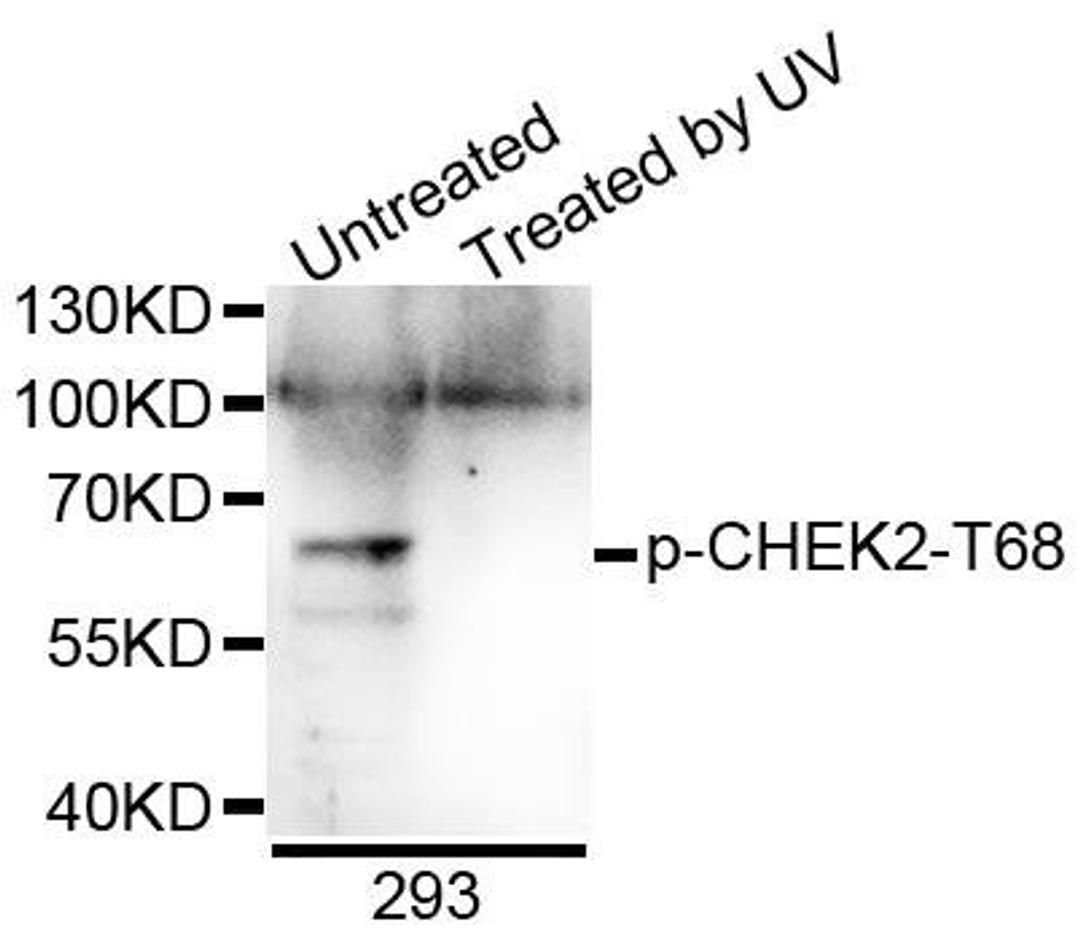 Western blot analysis of extracts of 293 cells using CHEK2 (Phospho-T68) antibody