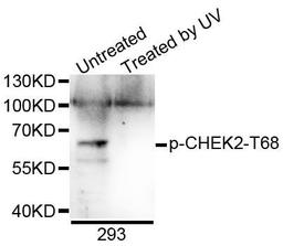 Western blot analysis of extracts of 293 cells using CHEK2 (Phospho-T68) antibody