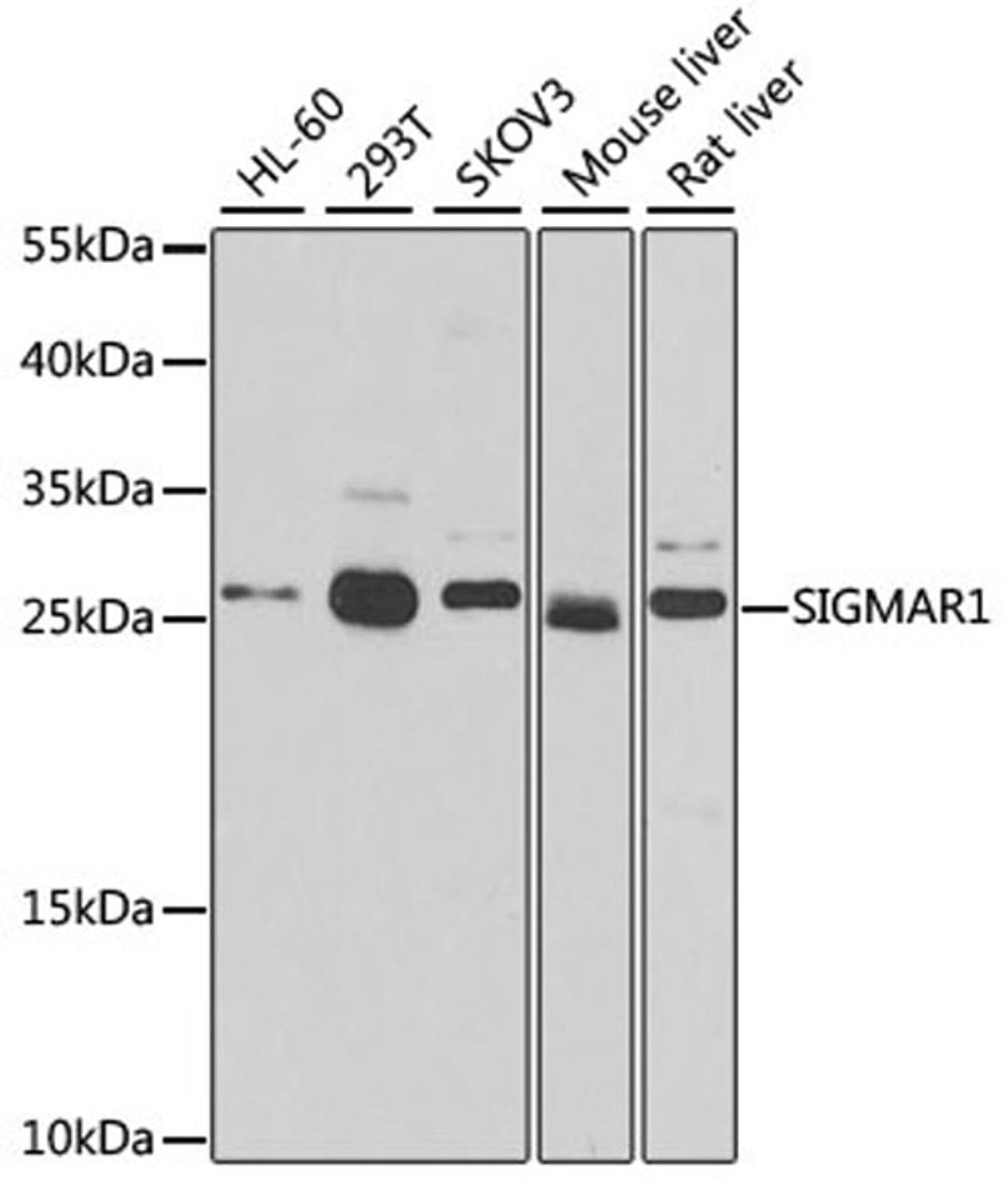 Western blot - SIGMAR1 antibody (A5479)