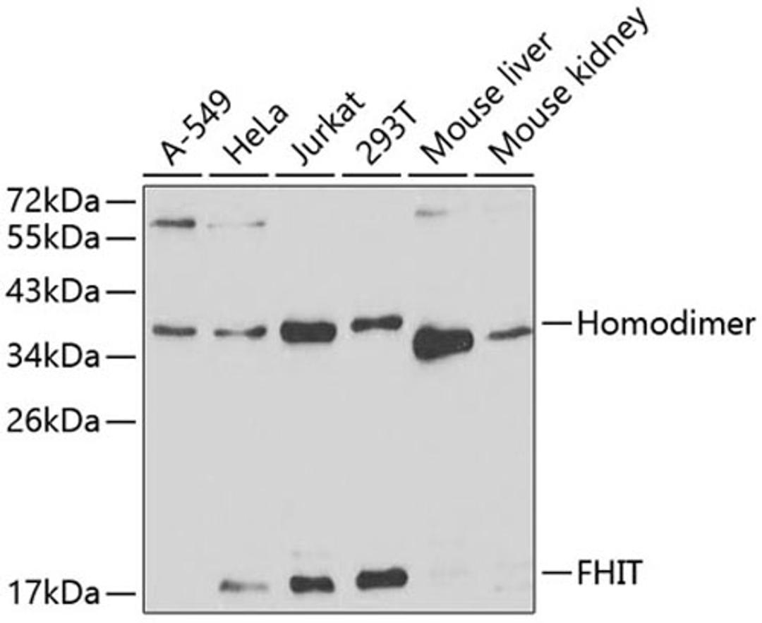 Western blot - FHIT antibody (A1196)