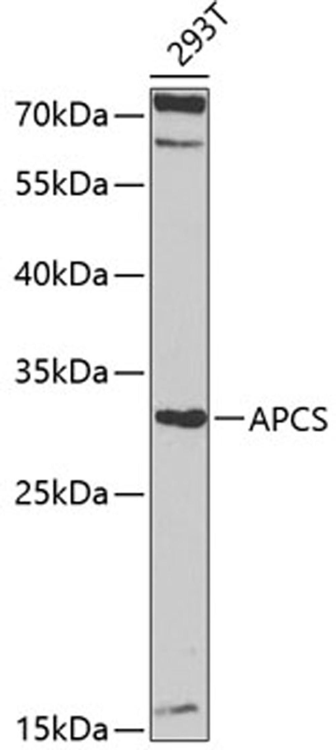 Western blot - APCS antibody (A1996)