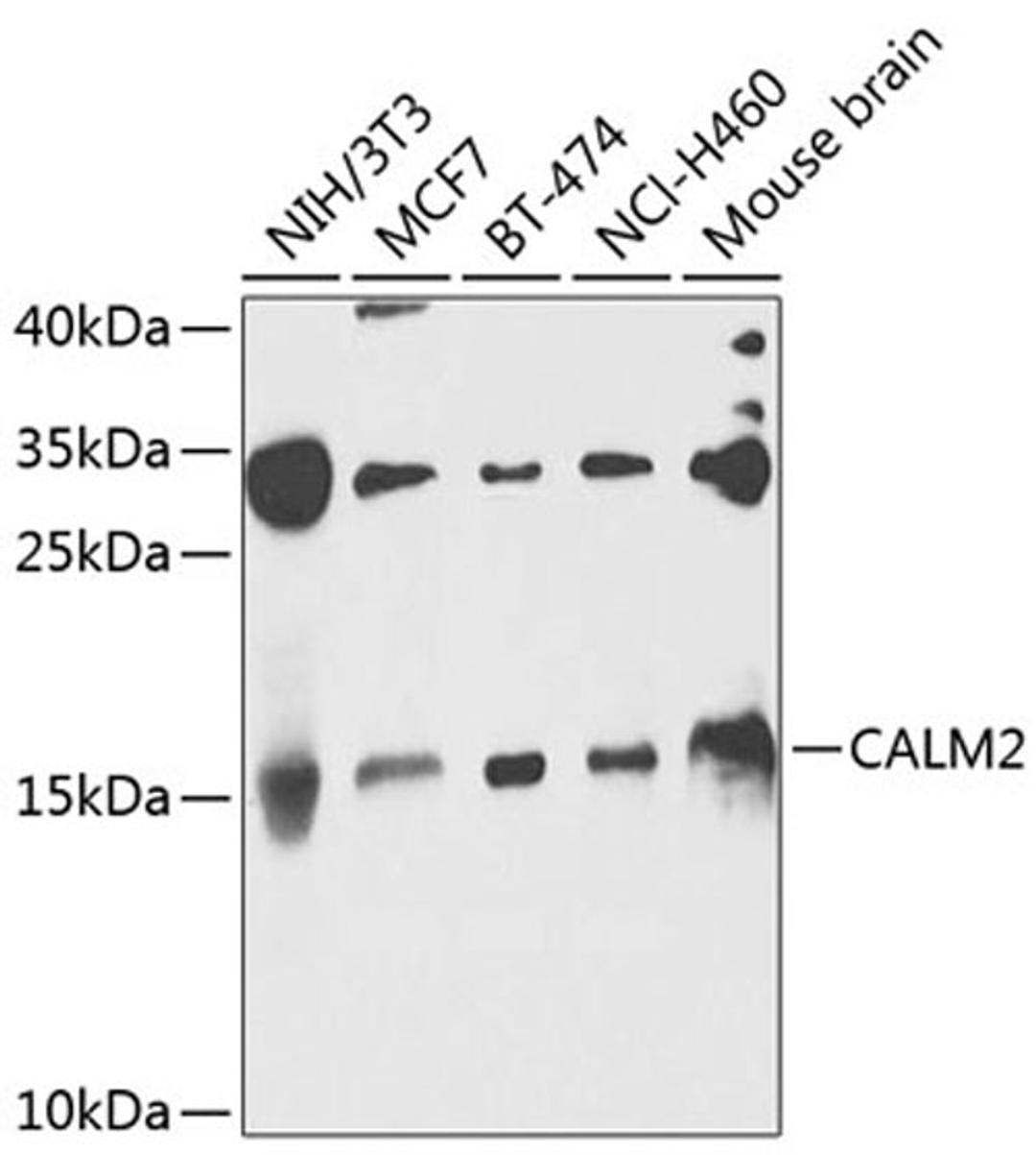 Western blot - CALM2 antibody (A8008)