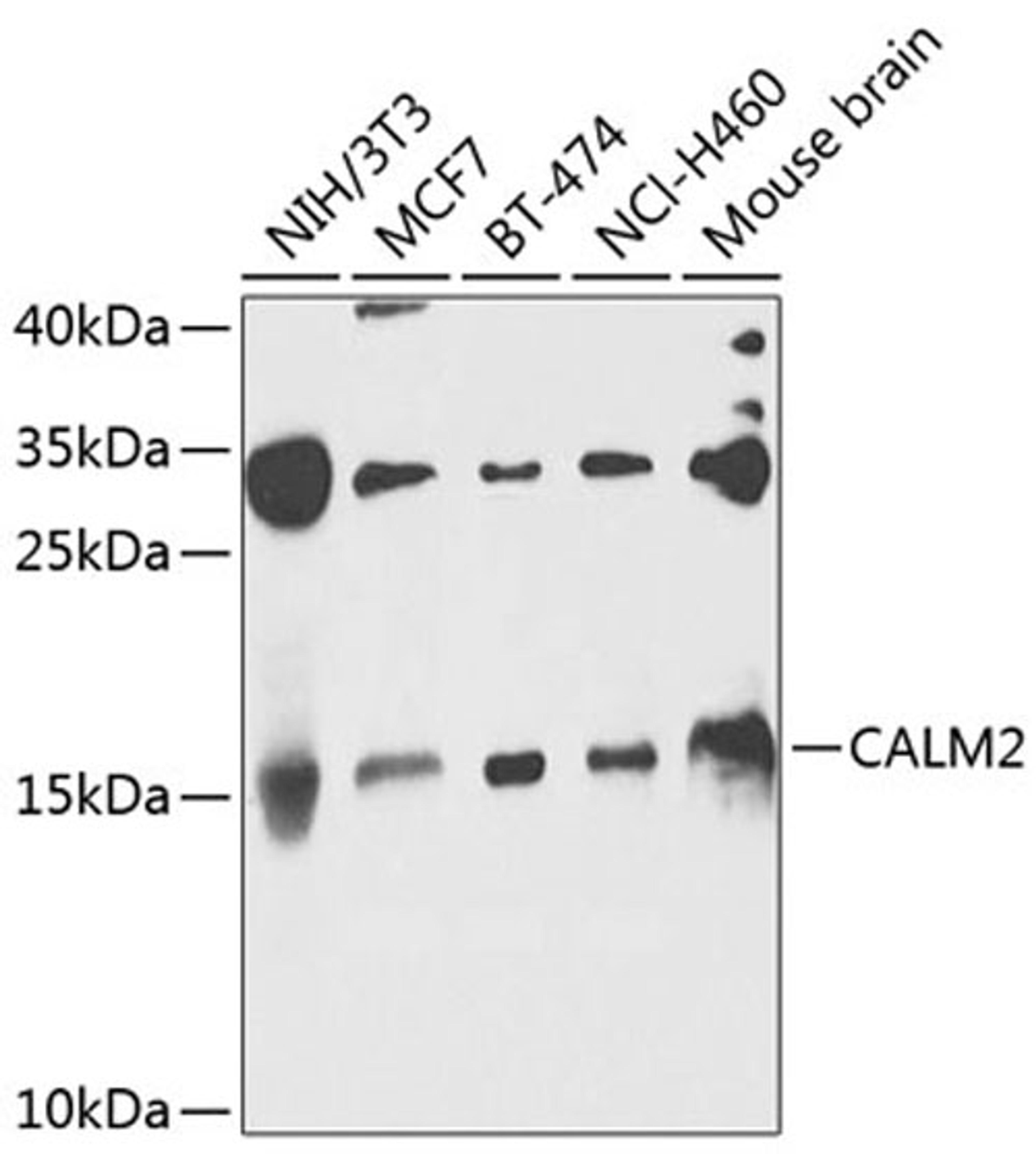 Western blot - CALM2 antibody (A8008)