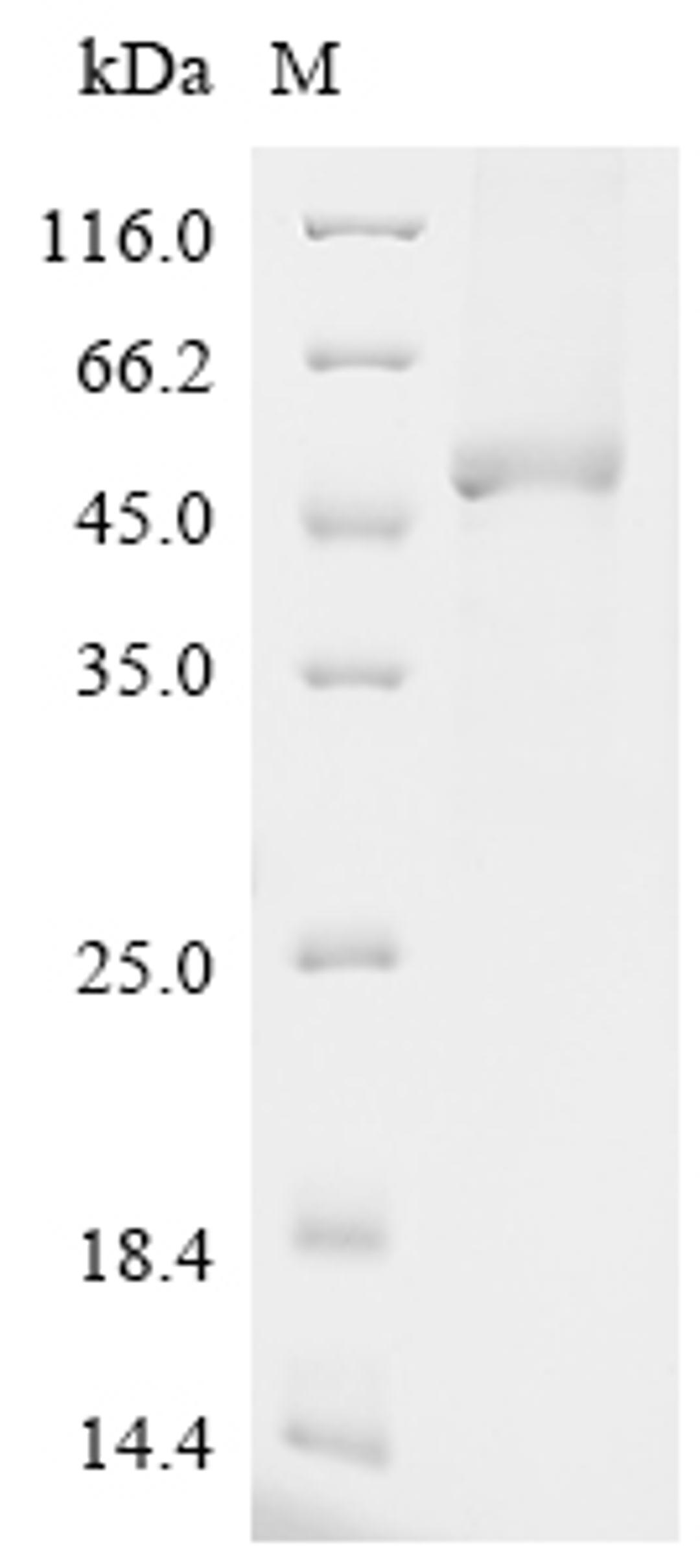 (Tris-Glycine gel) Discontinuous SDS-PAGE (reduced) with 5% enrichment gel and 15% separation gel.