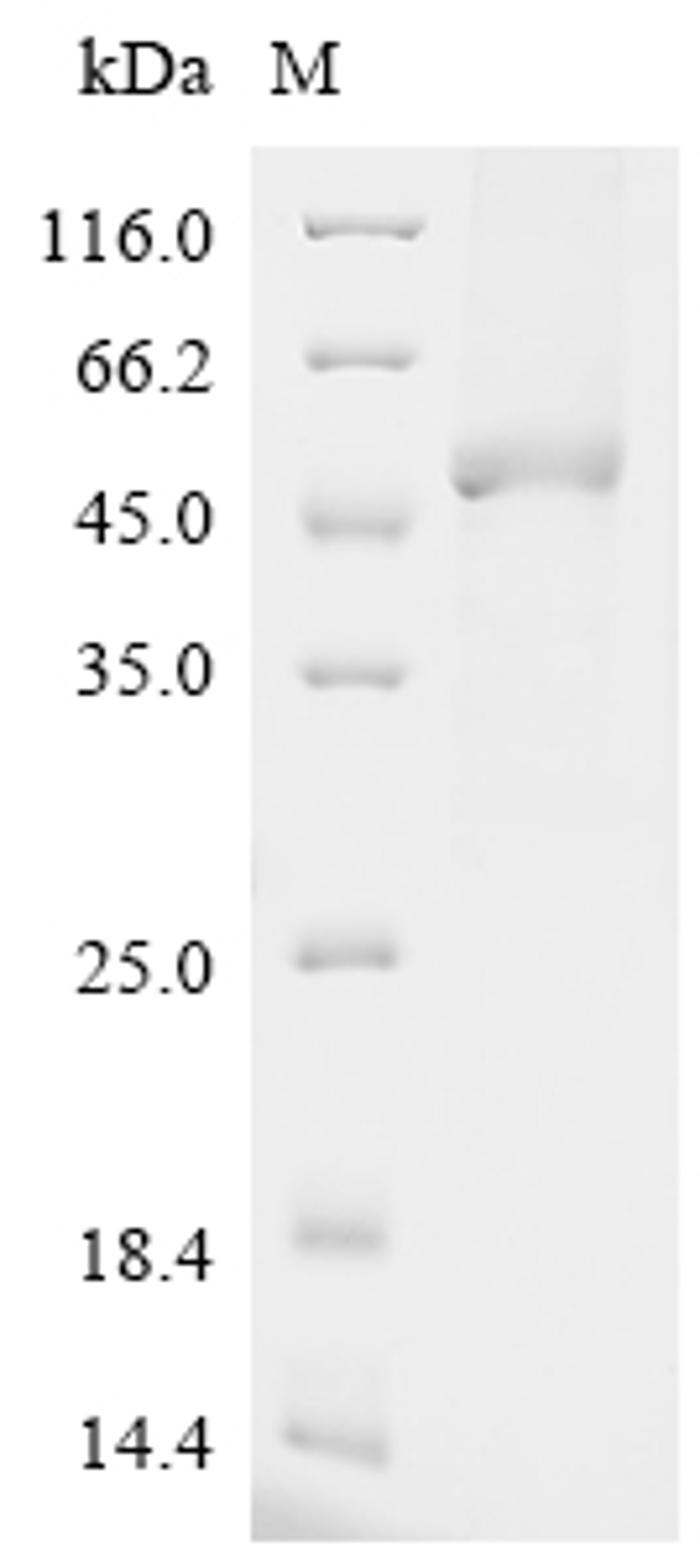 (Tris-Glycine gel) Discontinuous SDS-PAGE (reduced) with 5% enrichment gel and 15% separation gel.