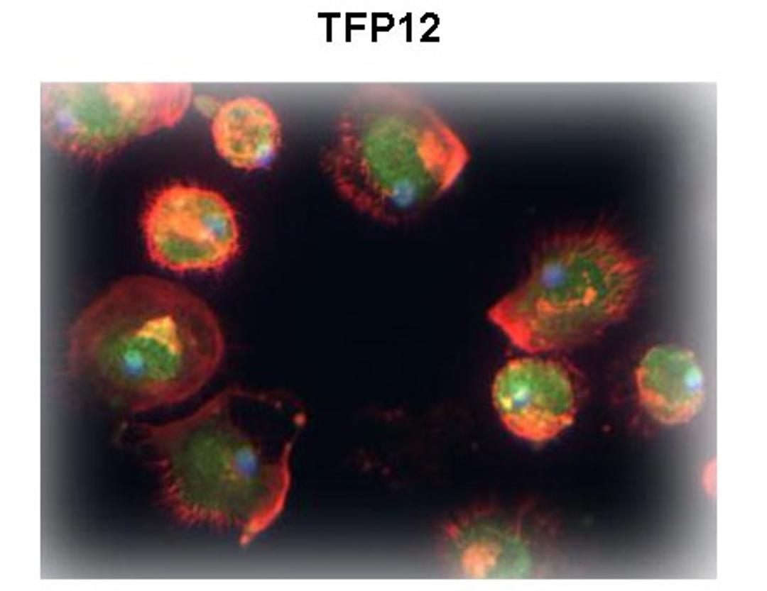 Antibody used in IHC on Human Macrophage at 1:2000.