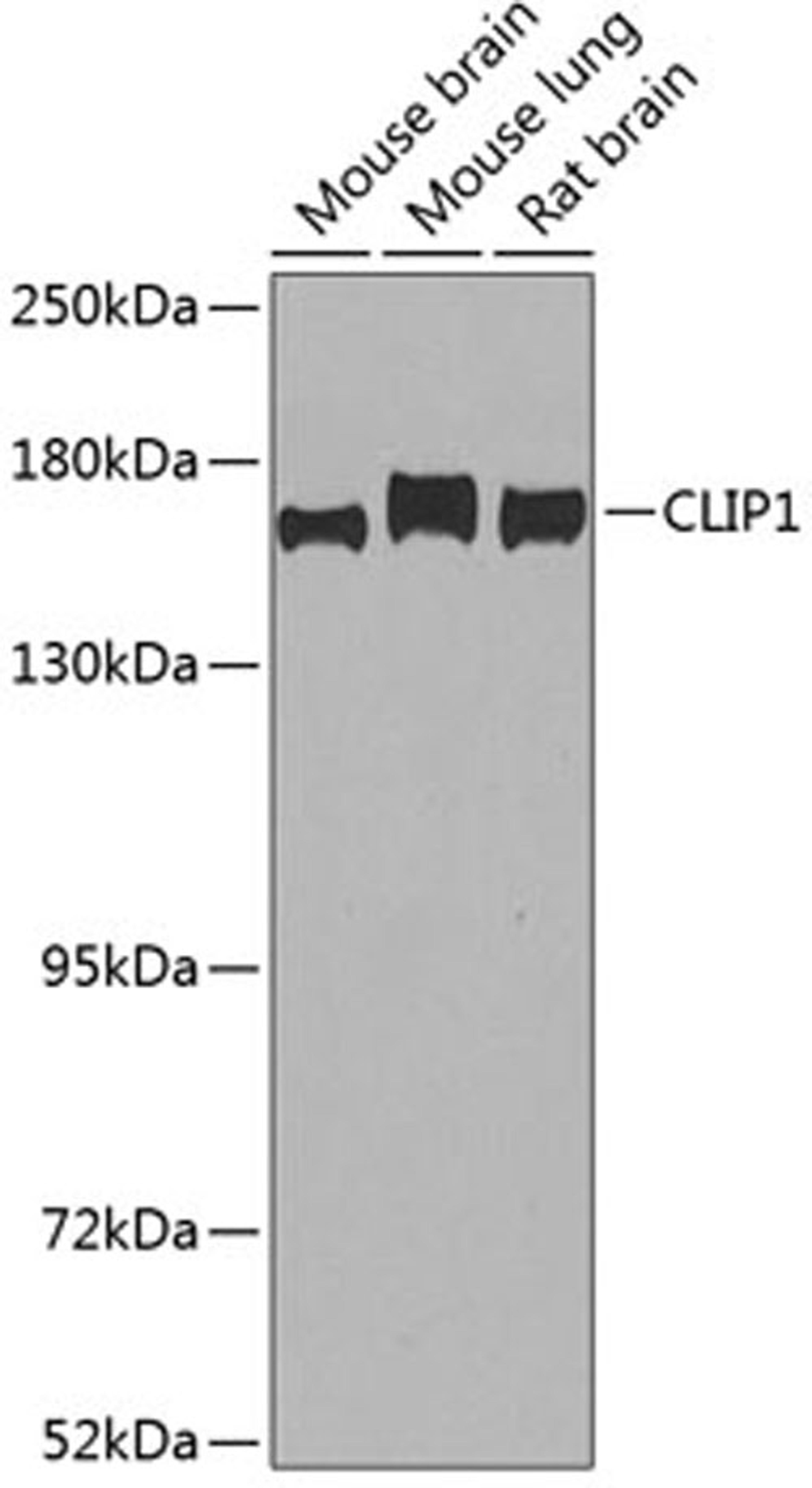 Western blot - CLIP1 antibody (A7722)