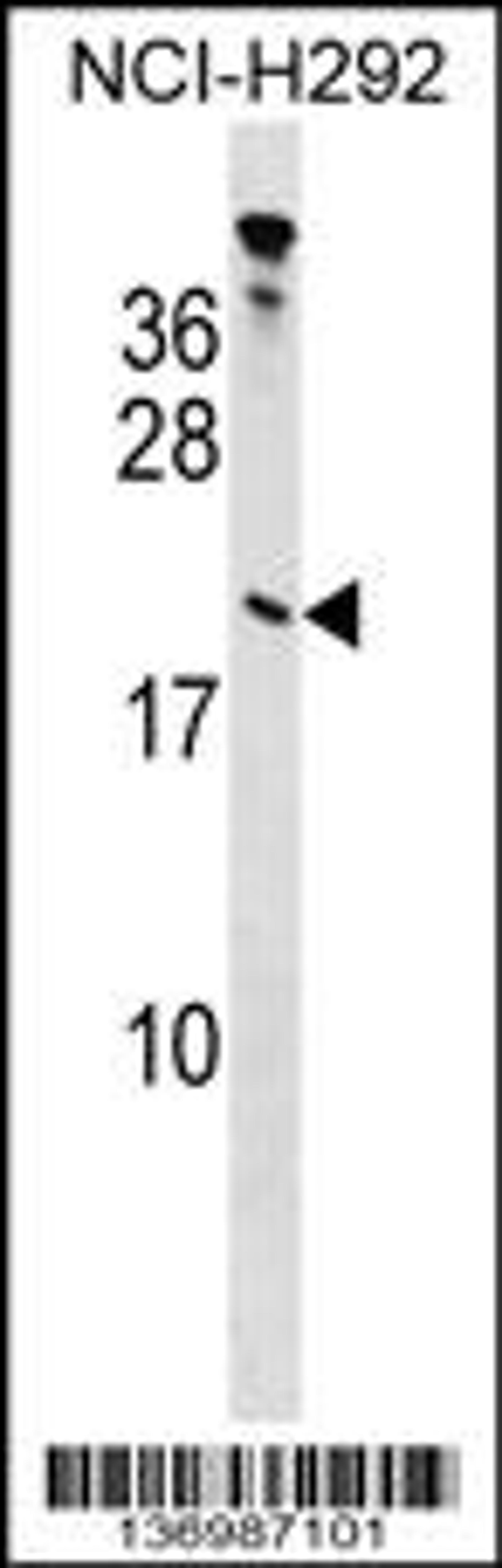 Western blot analysis in NCI-H292 cell line lysates (35ug/lane).