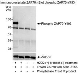 Detection of Phosphorylation of human ZAP70 on Y493 by western blot of immunoprecipitates.