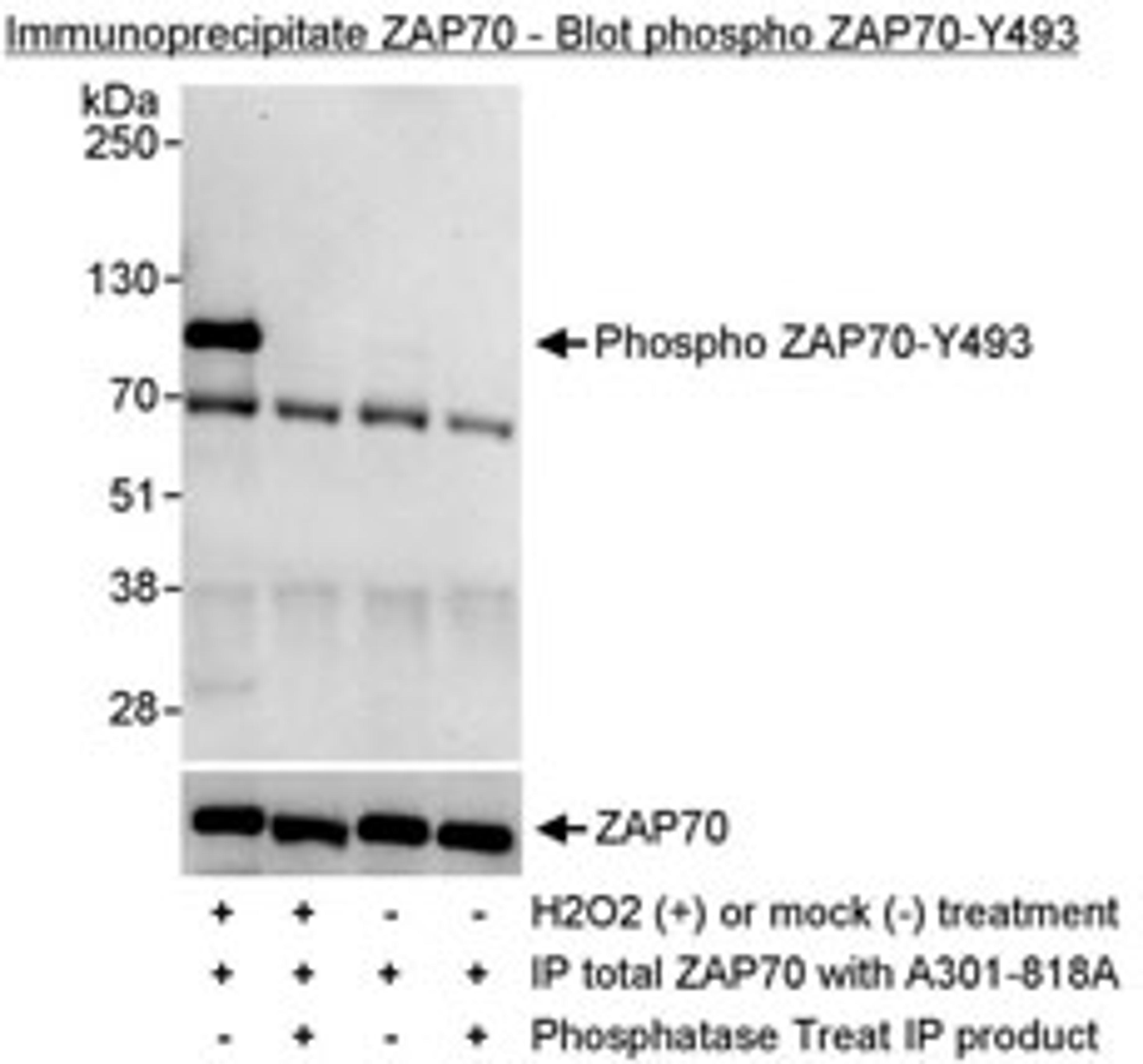 Detection of Phosphorylation of human ZAP70 on Y493 by western blot of immunoprecipitates.