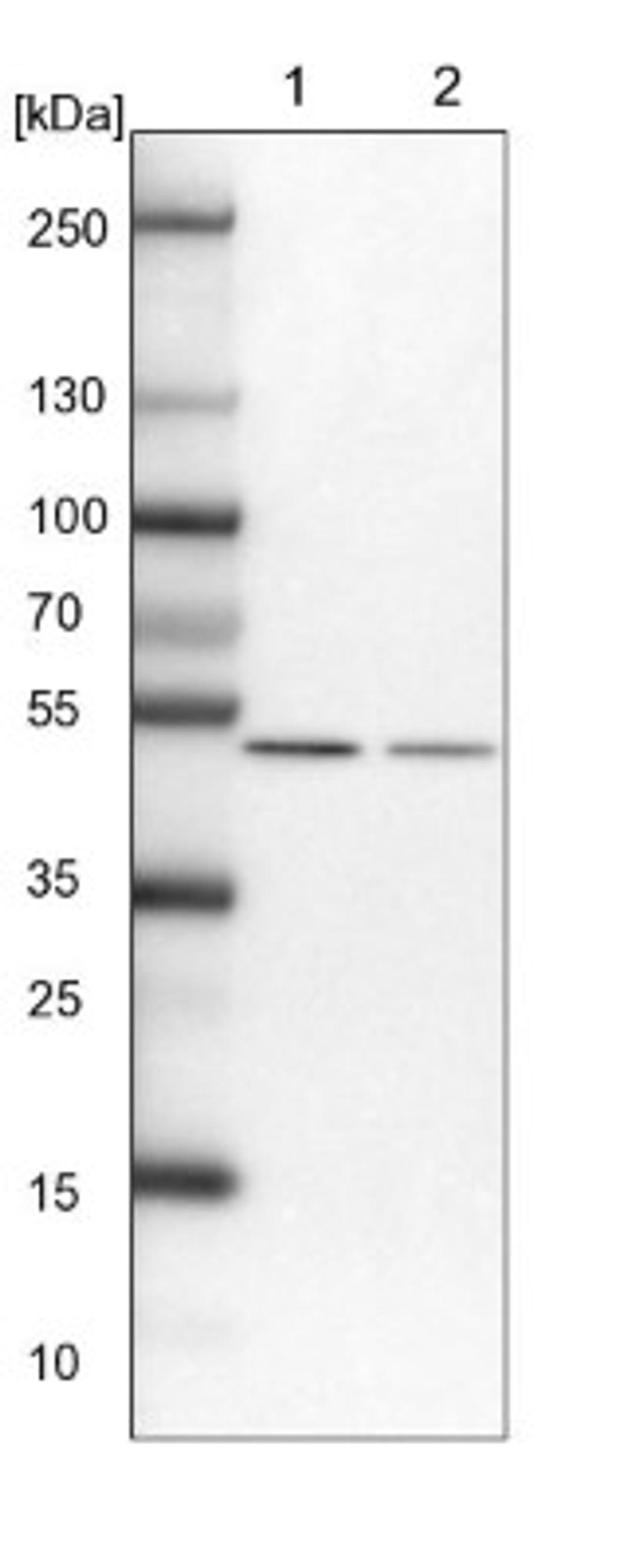 Western Blot: Septin-7 Antibody [NBP1-85730] - Lane 1: NIH-3T3 cell lysate (Mouse embryonic fibroblast cells)<br/>Lane 2: NBT-II cell lysate (Rat Wistar bladder tumour cells)