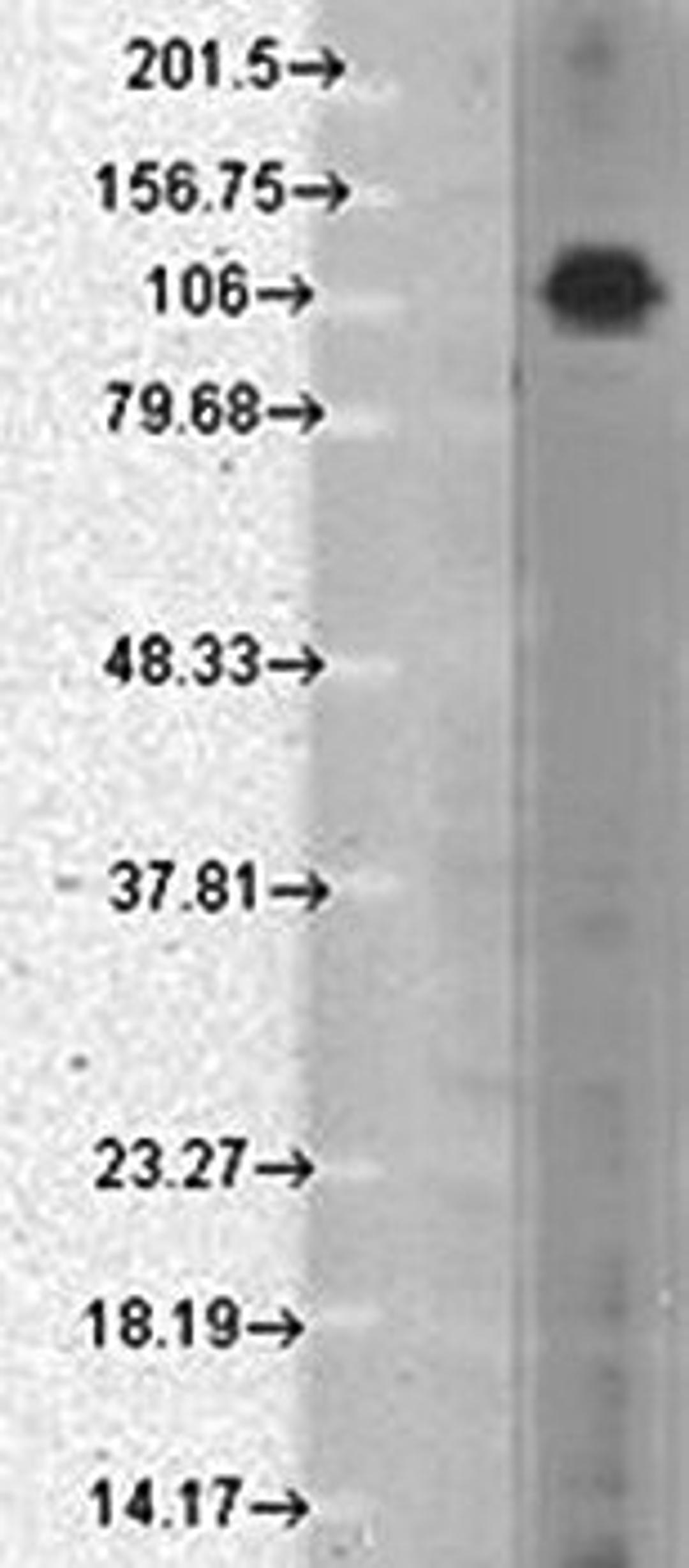 Western blot analysis of rat brain membrane lysates using Chapsyn110 antibody