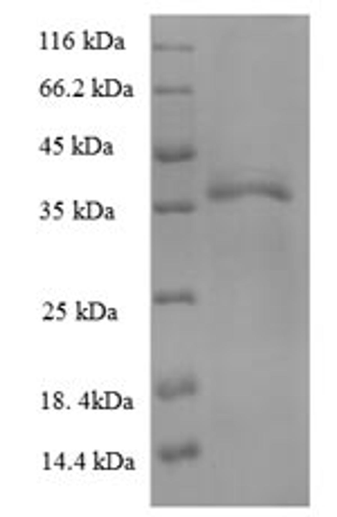 (Tris-Glycine gel) Discontinuous SDS-PAGE (reduced) with 5% enrichment gel and 15% separation gel.