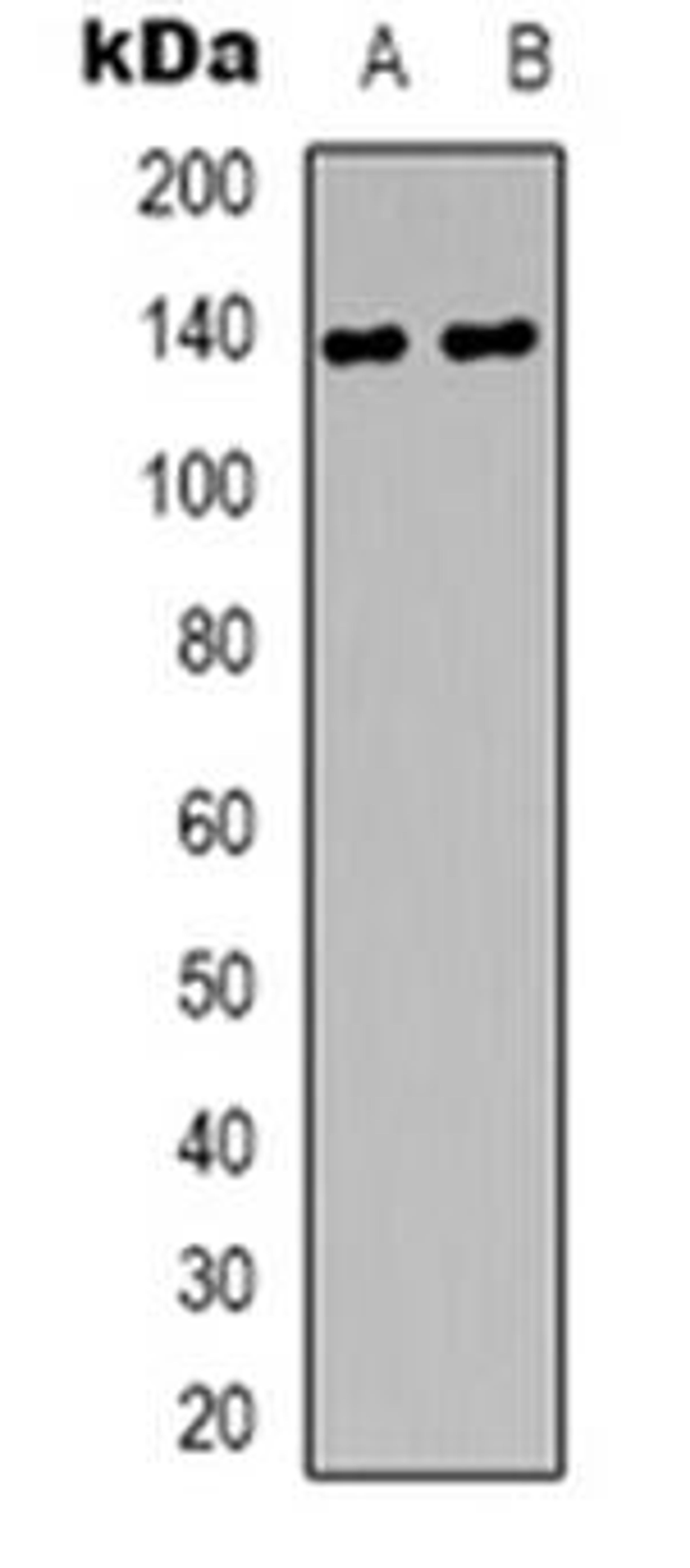 Western blot analysis of DZIP3 expression in HEK293T (Lane 1), A431 (Lane 2) whole cell lysates using DZIP3 antibody