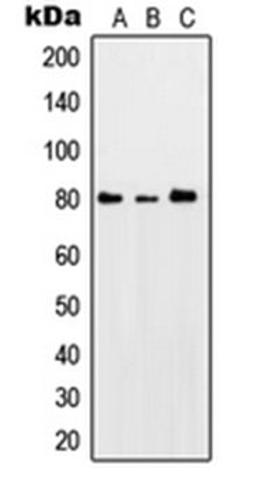 Western blot analysis of HeLa UV-treated (Lane 1), SP2/0 UV-treated (Lane 2), PC12 UV-treated (Lane 3) whole cell lysates using PRKCQ antibody