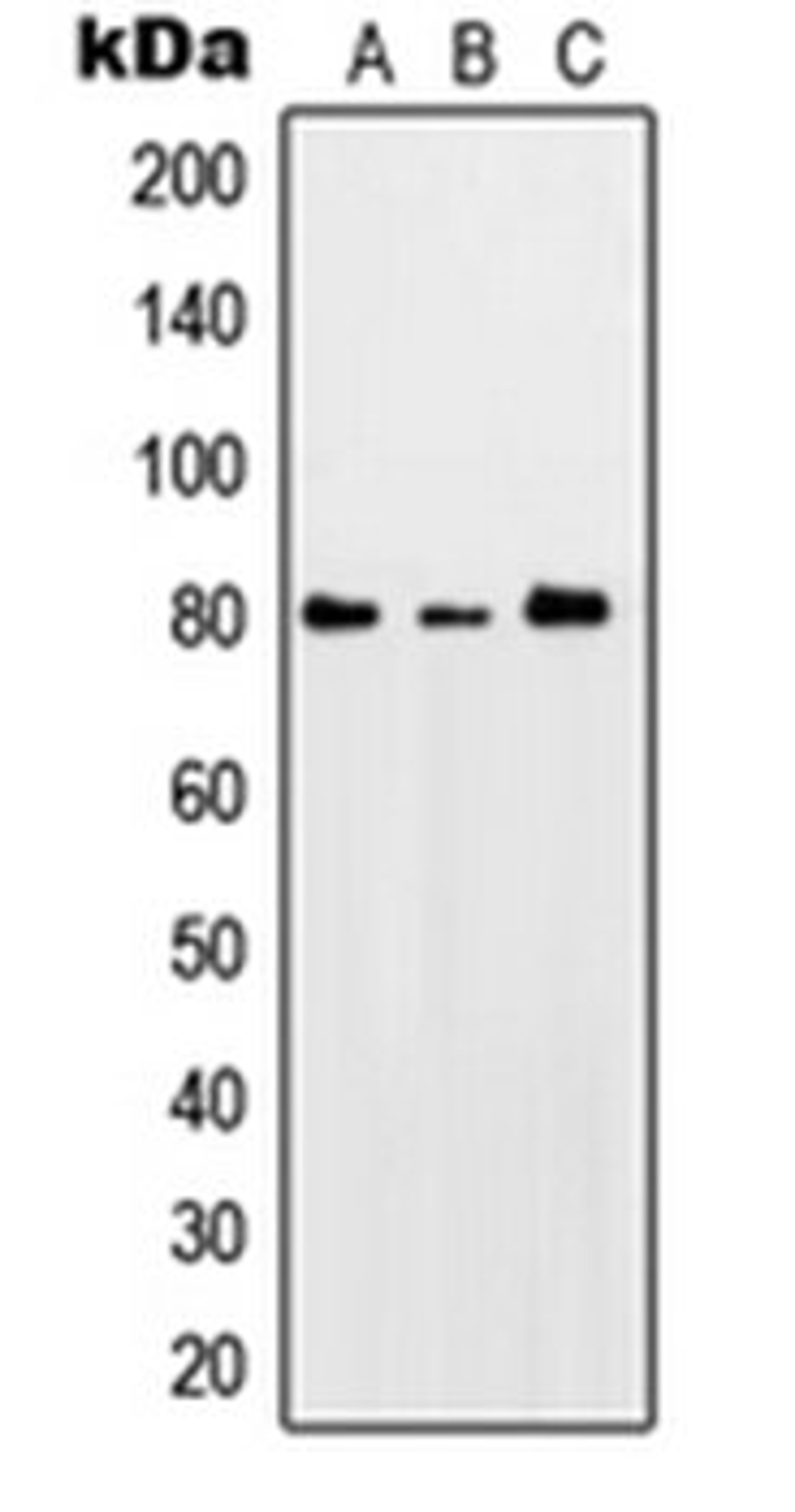 Western blot analysis of HeLa UV-treated (Lane 1), SP2/0 UV-treated (Lane 2), PC12 UV-treated (Lane 3) whole cell lysates using PRKCQ antibody