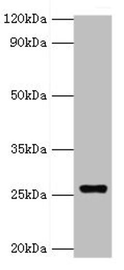 Western blot. All lanes: GSTA4 antibody at 8ug/ml + 293T whole cell lysate. Secondary. Goat polyclonal to rabbit IgG at 1/10000 dilution. Predicted band size: 26, 15 kDa. Observed band size: 26 kDa. 
