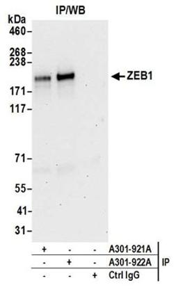 Detection of human ZEB1 by western blot of immunoprecipitates.