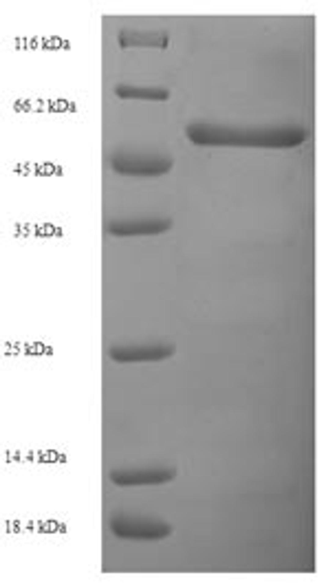(Tris-Glycine gel) Discontinuous SDS-PAGE (reduced) with 5% enrichment gel and 15% separation gel.