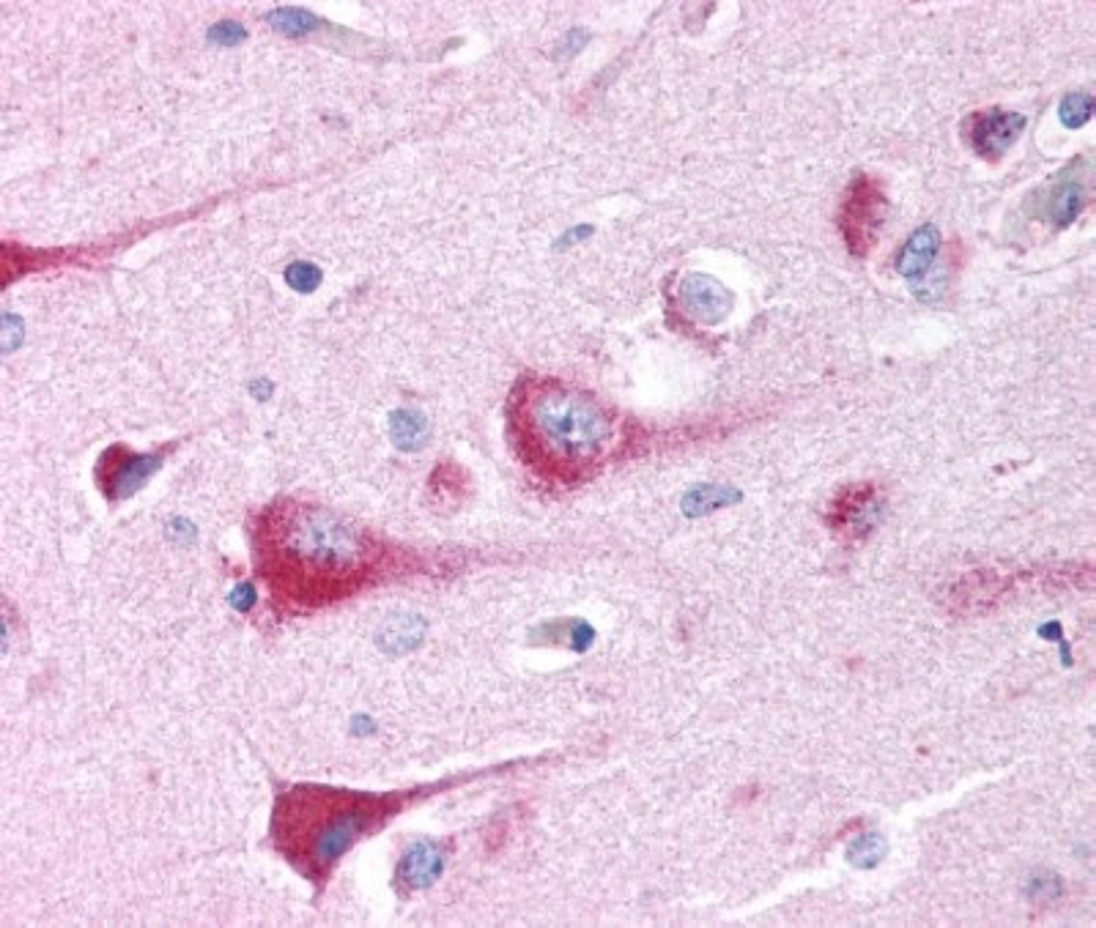 Immunohistochemistry: TMP21 Antibody [NB110-57586] - Detection of TMP21 in central neurons.