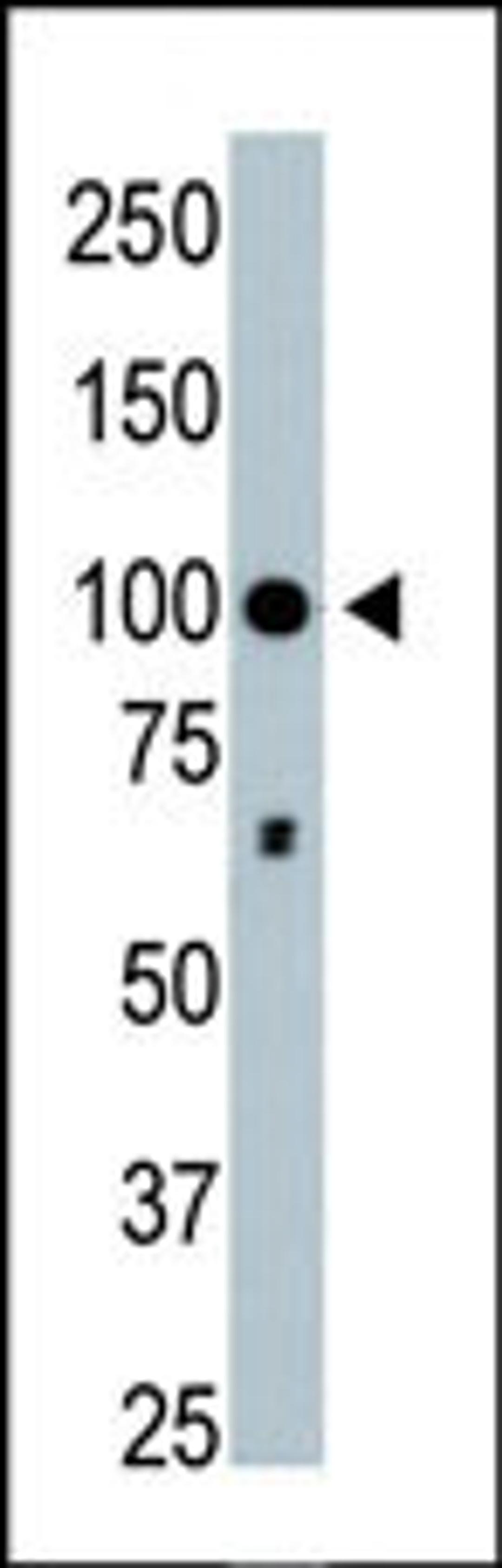 Antibody is used in Western blot to detect HDAC4 in mouse brain tissue lysate.