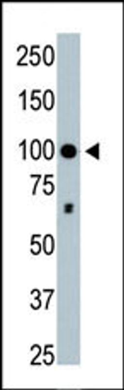 Antibody is used in Western blot to detect HDAC4 in mouse brain tissue lysate.