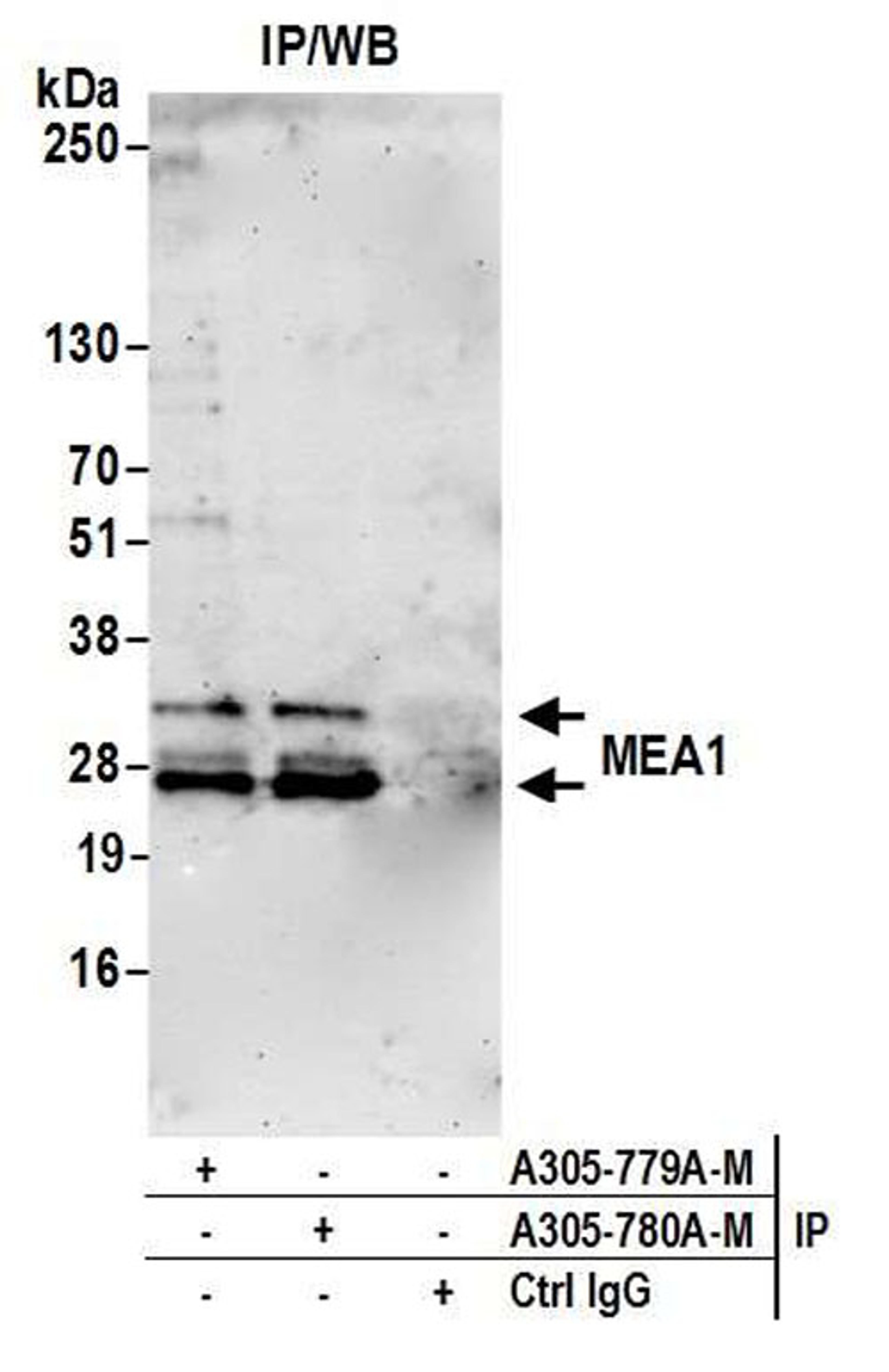 Detection of human MEA1 by WB of IP.